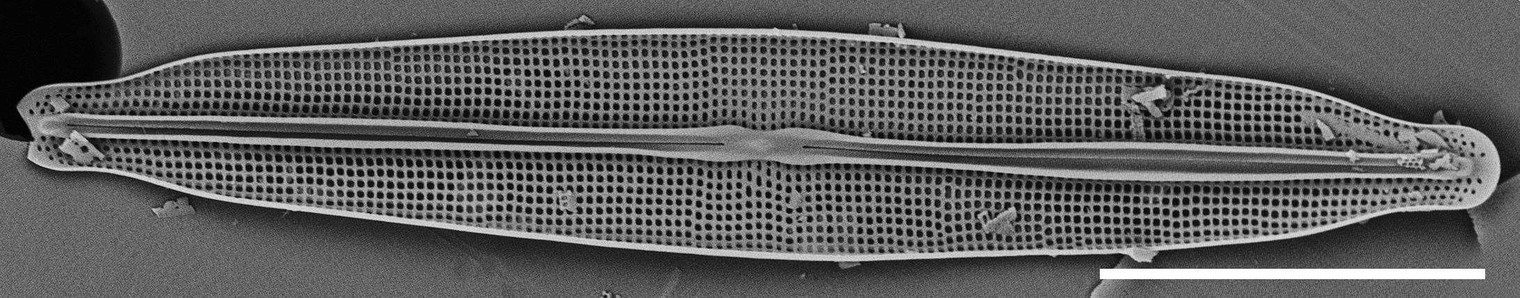 Frustulia pseudomagaliesmontana SEM1