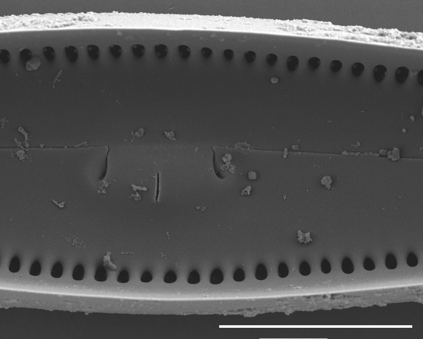 Gomphoneis oreophila SEM4