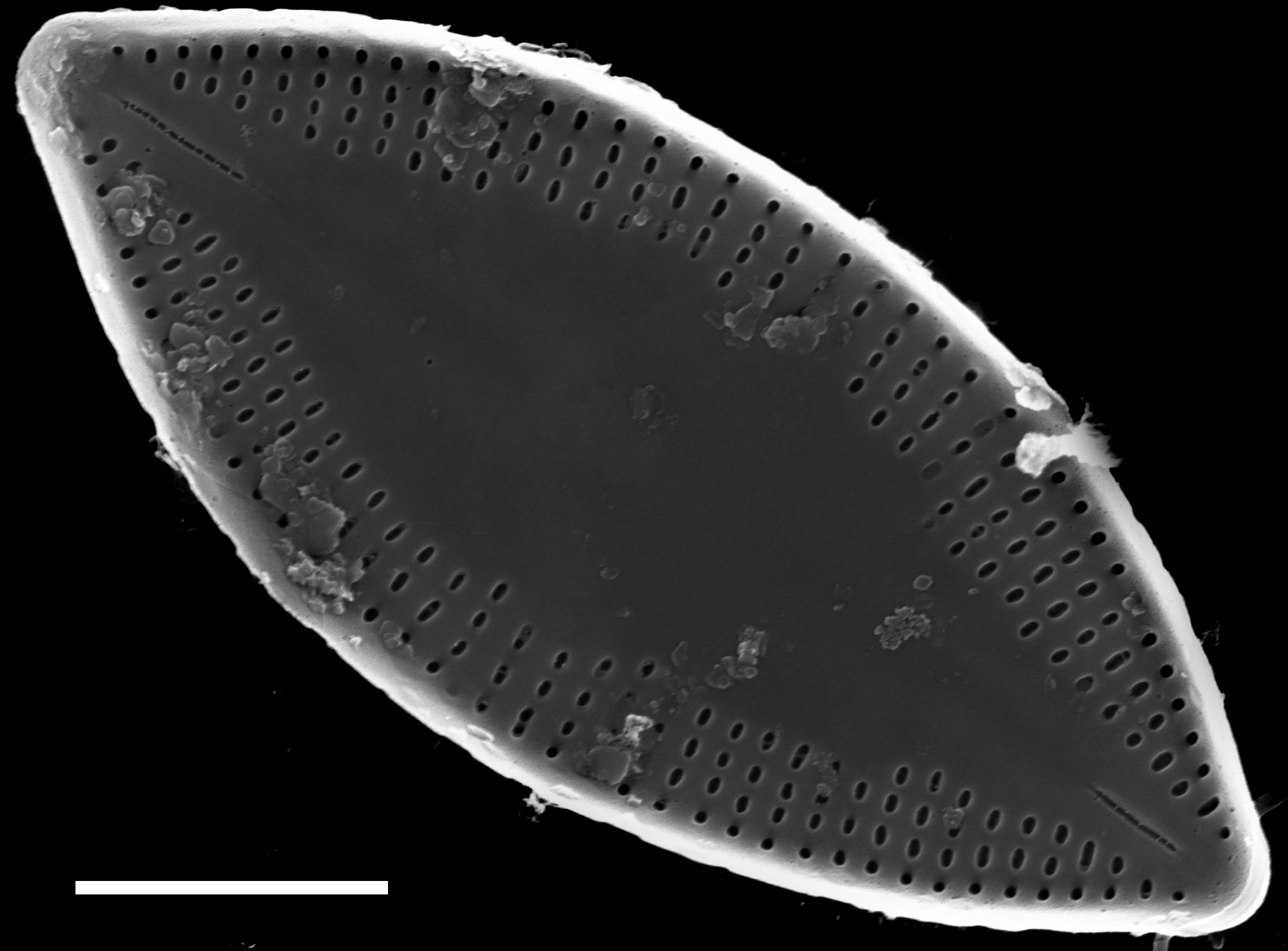 Nupela decipiens SEM1