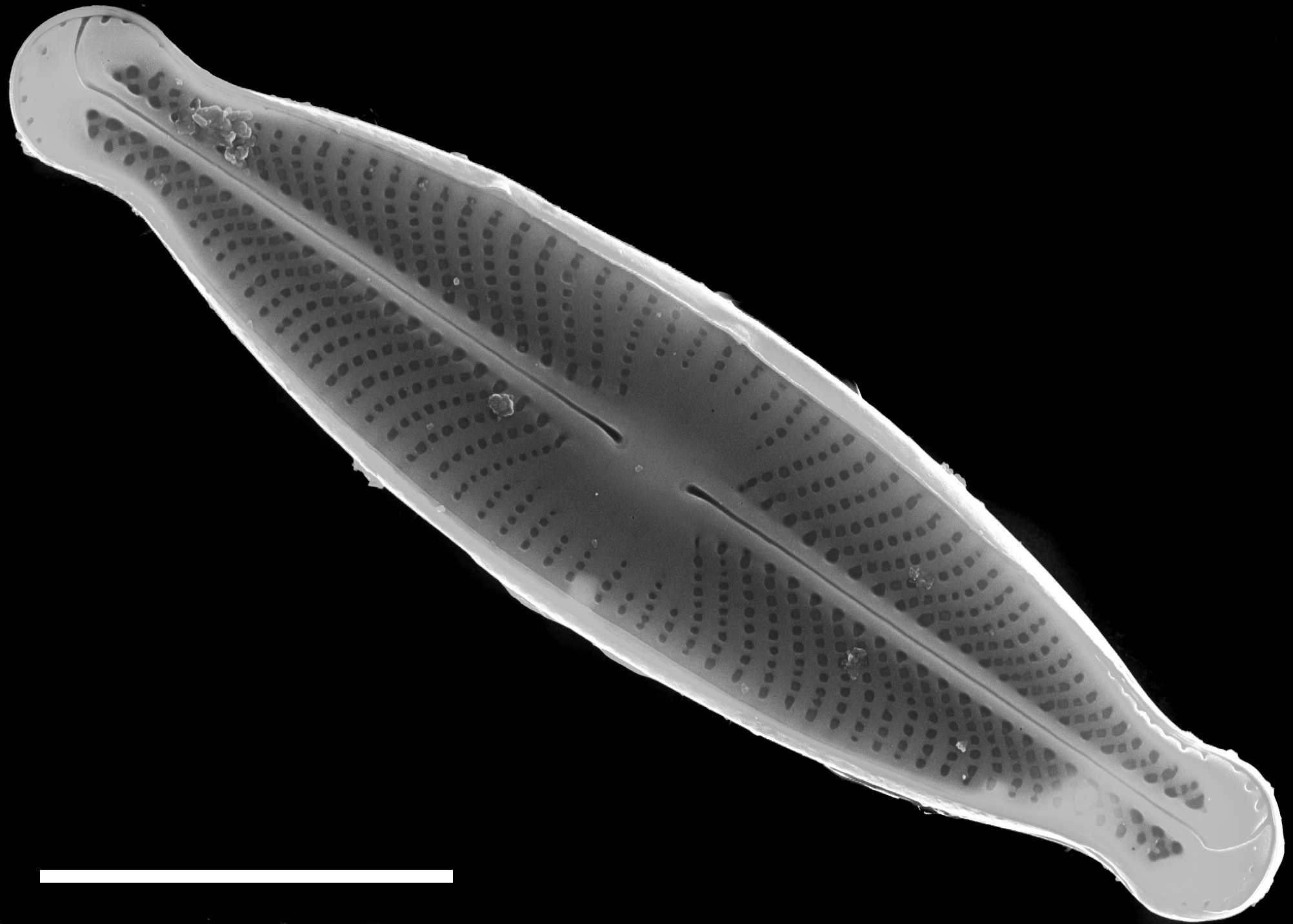 Sellaphora subfasciata SEM1