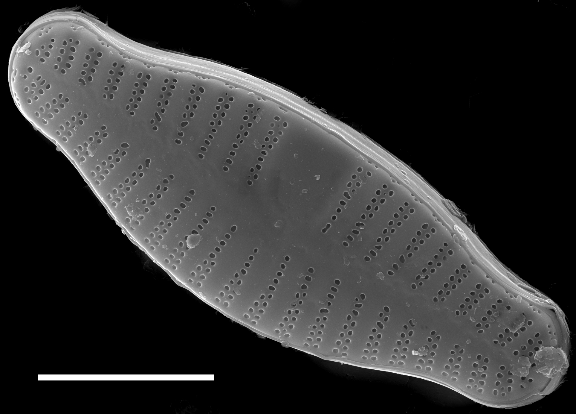 Planothidium biporomum SEM1