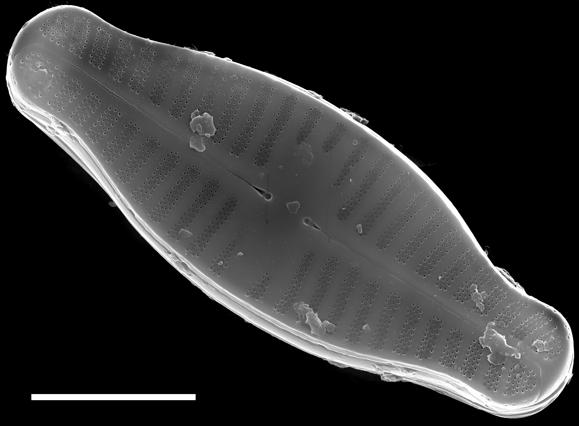 Planothidium biporomum SEM2