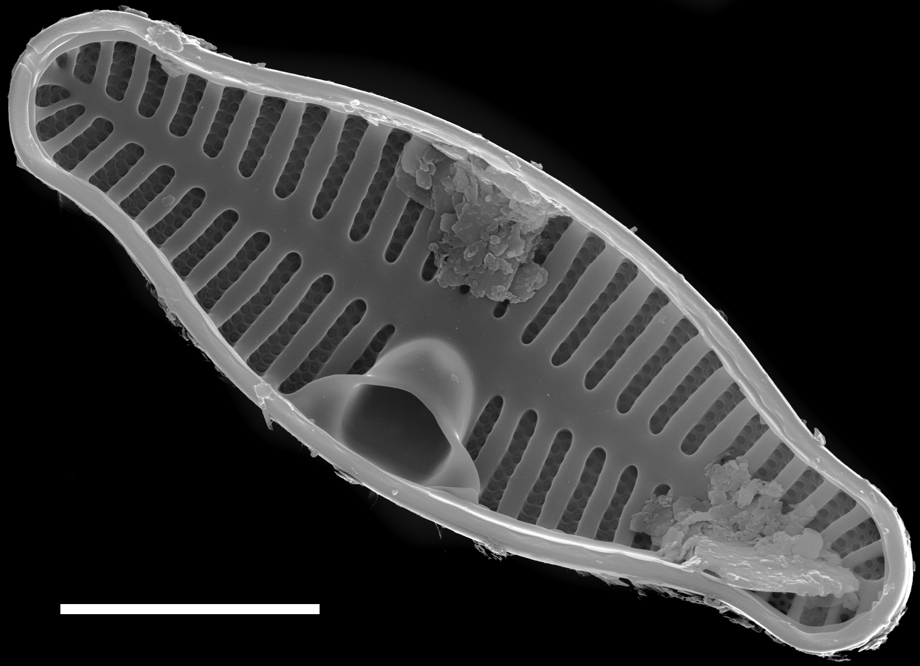 Planothidium biporomum SEM3