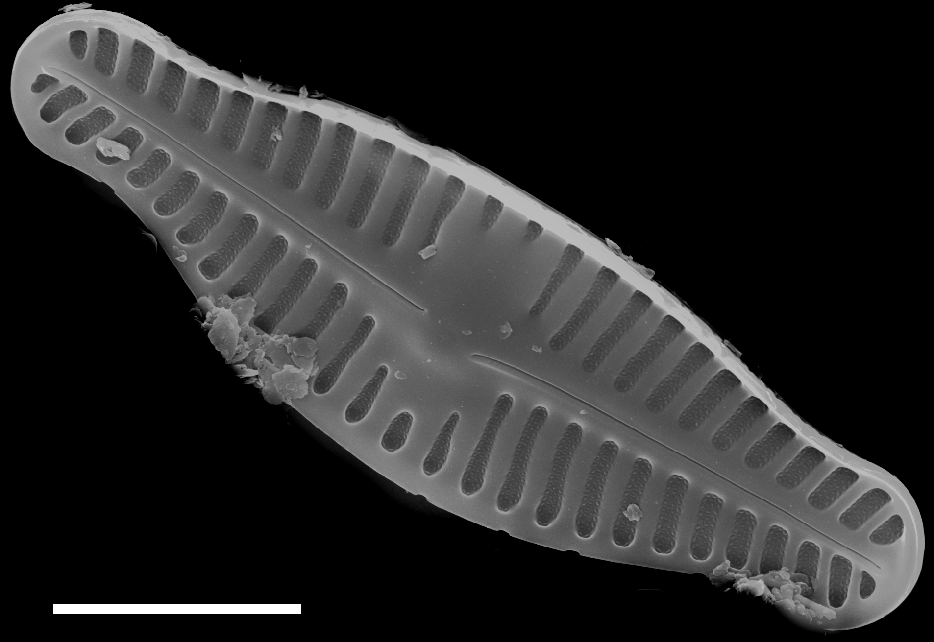 Planothidium biporomum SEM4