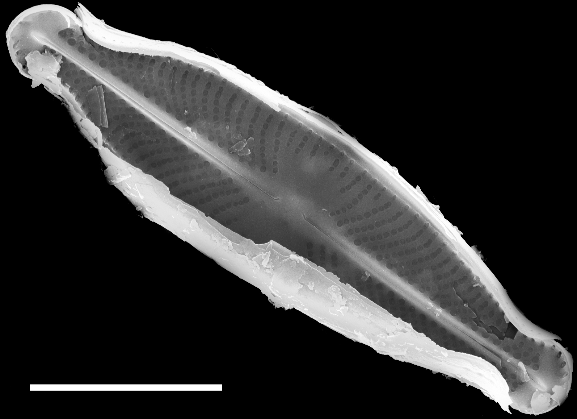 Sellaphora subfasciata SEM2