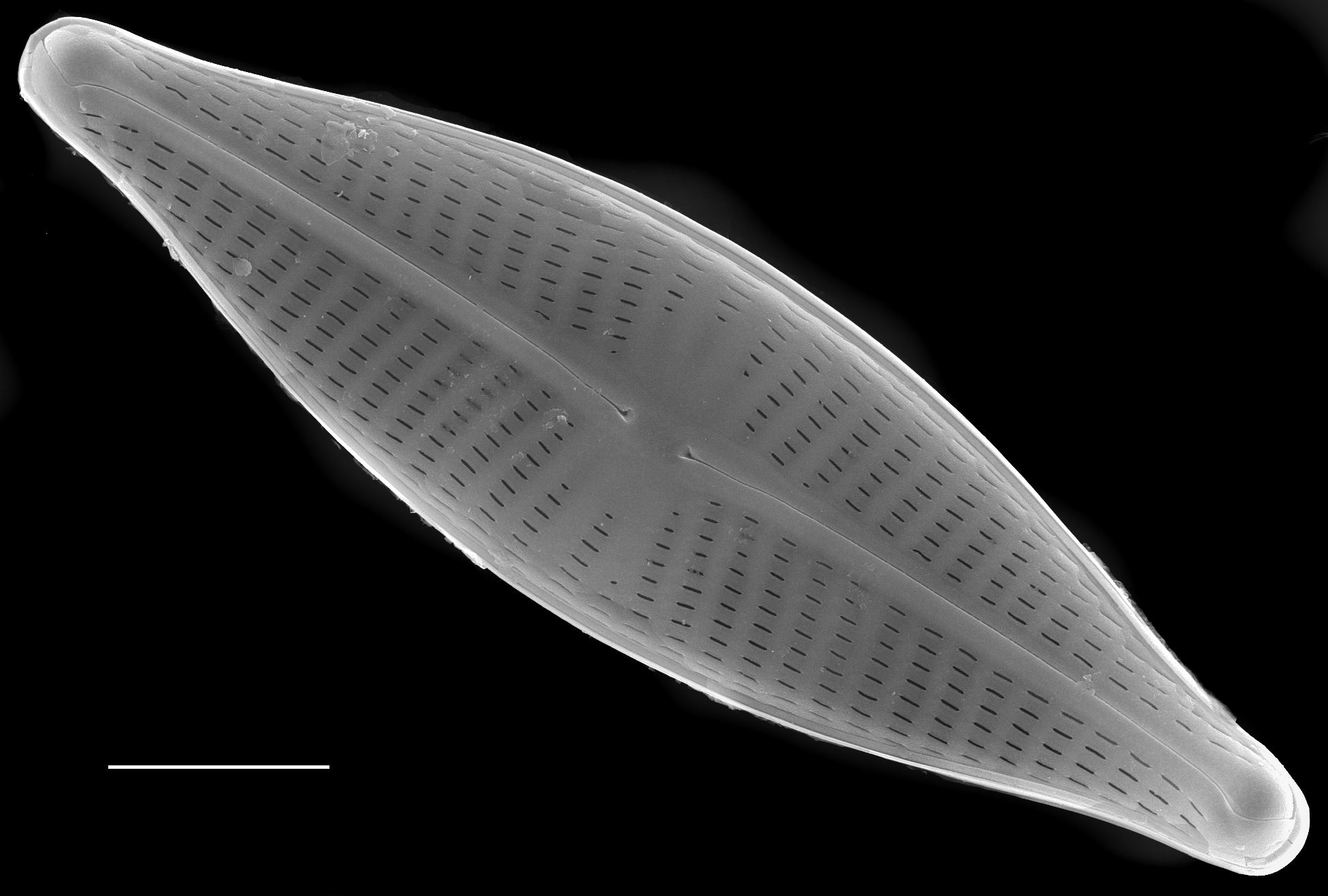 Navicula cryptocephala SEM1