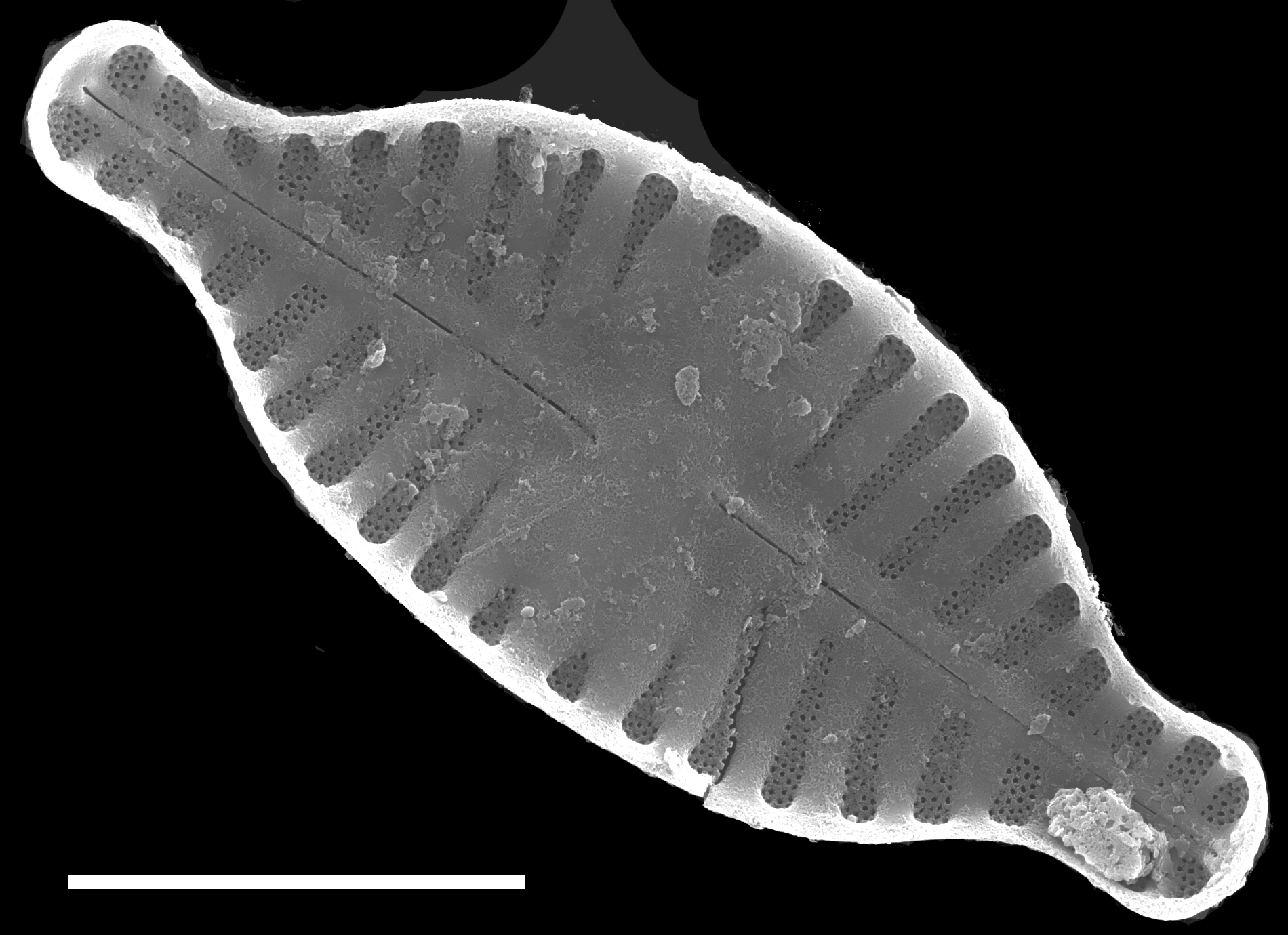 Planothidium rostratum SEM1