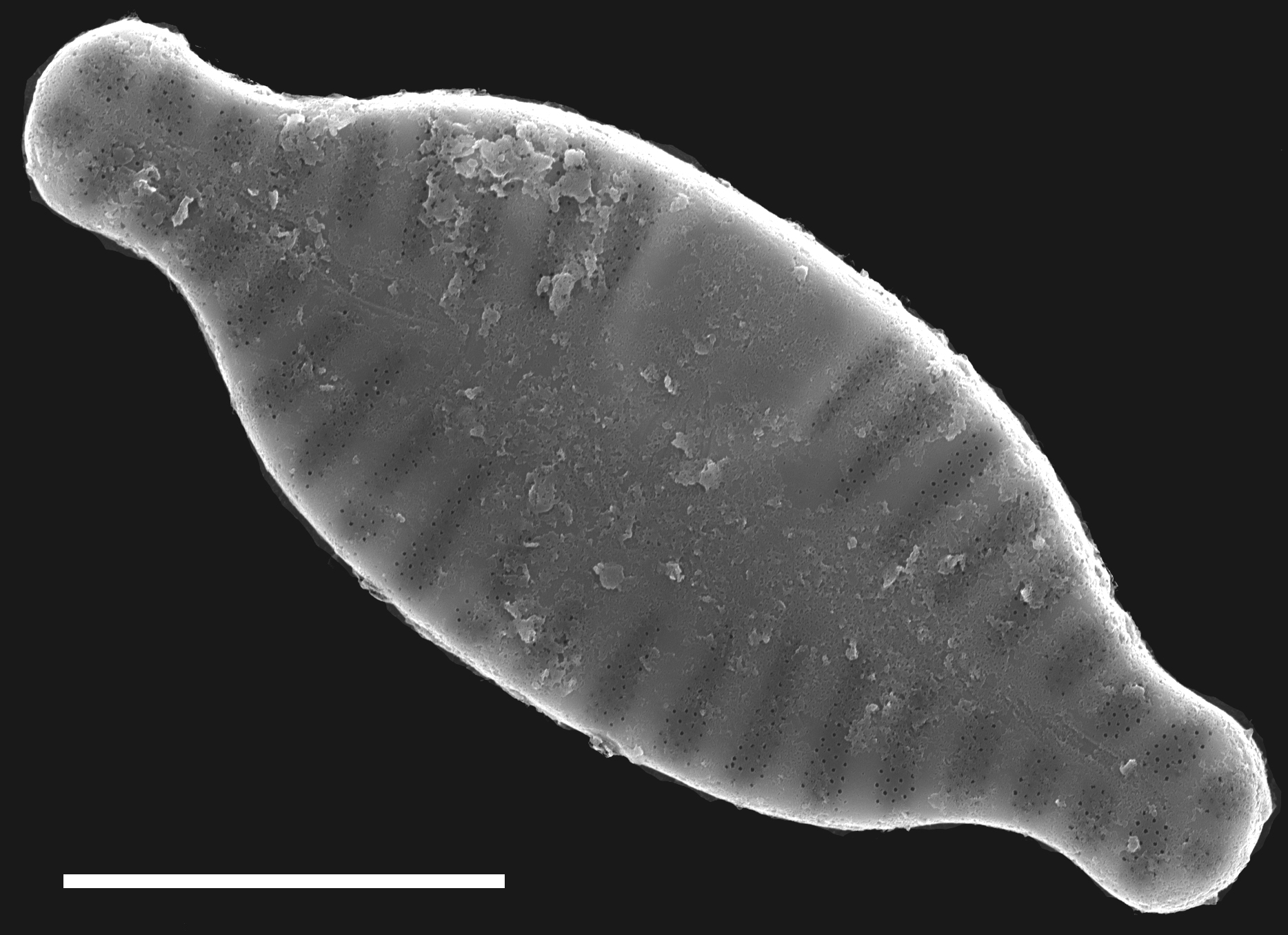 Planothidium rostratum SEM3