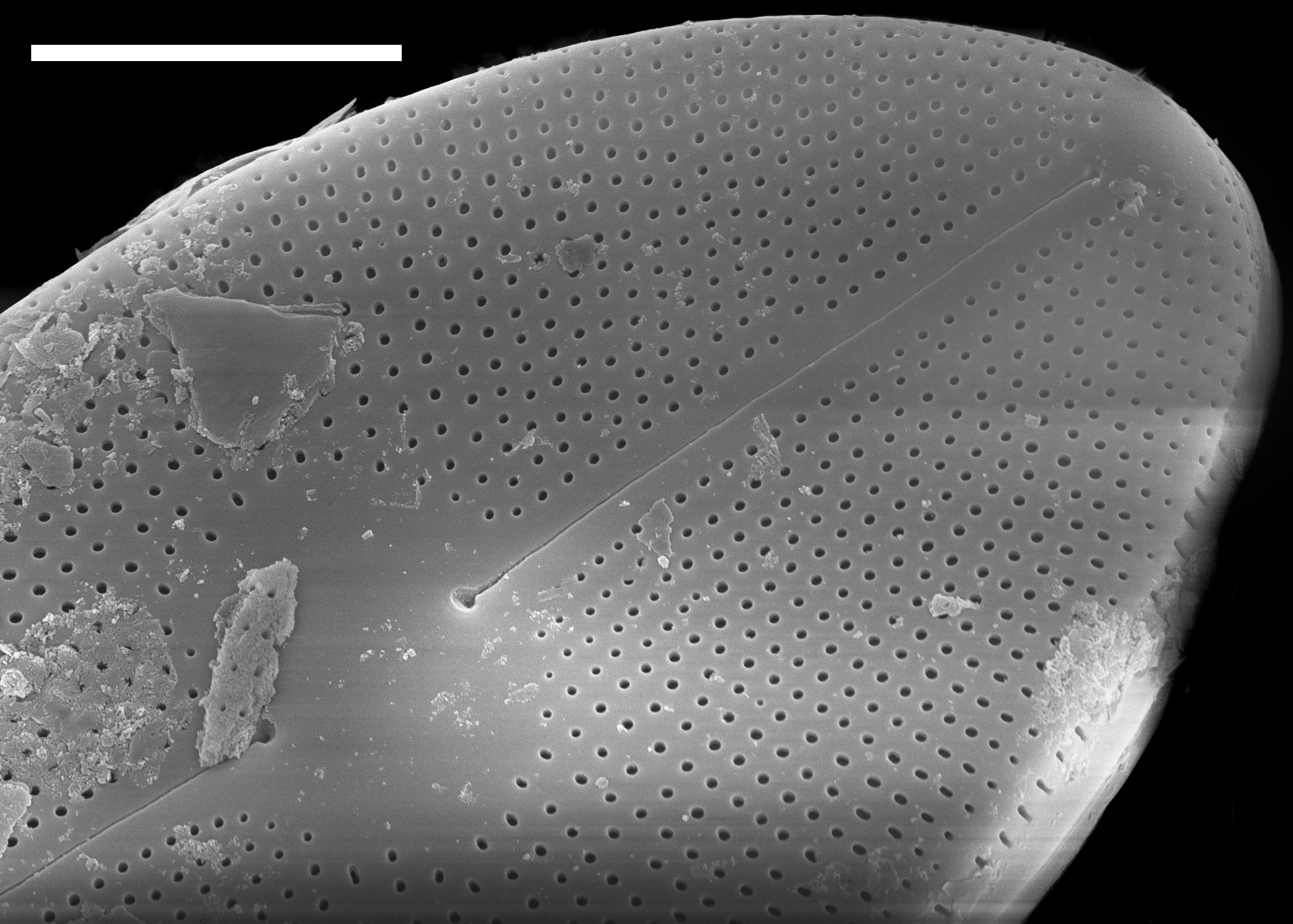 Cavinula maculata SEM1