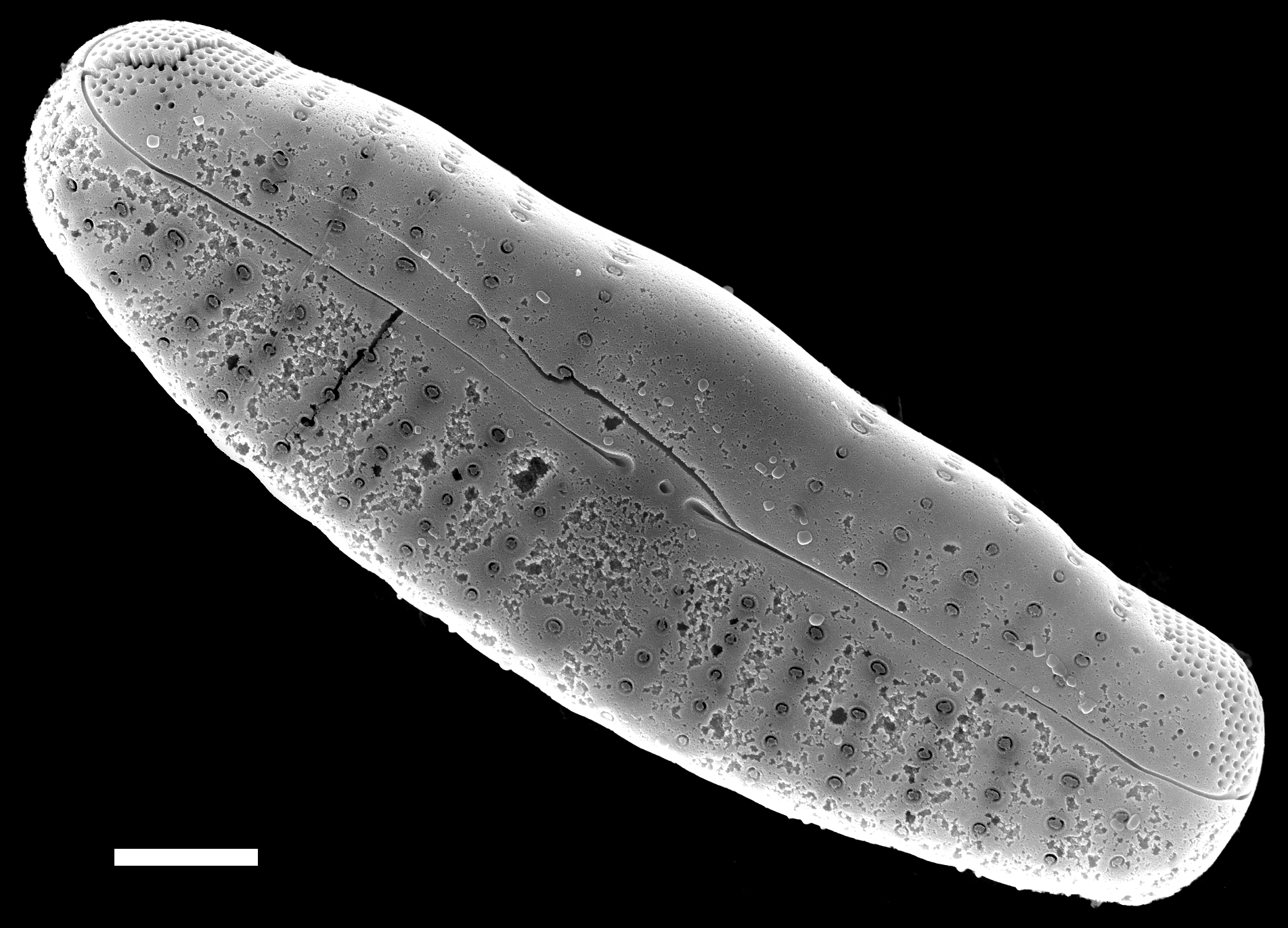 Reimeria uniseriata SEM1