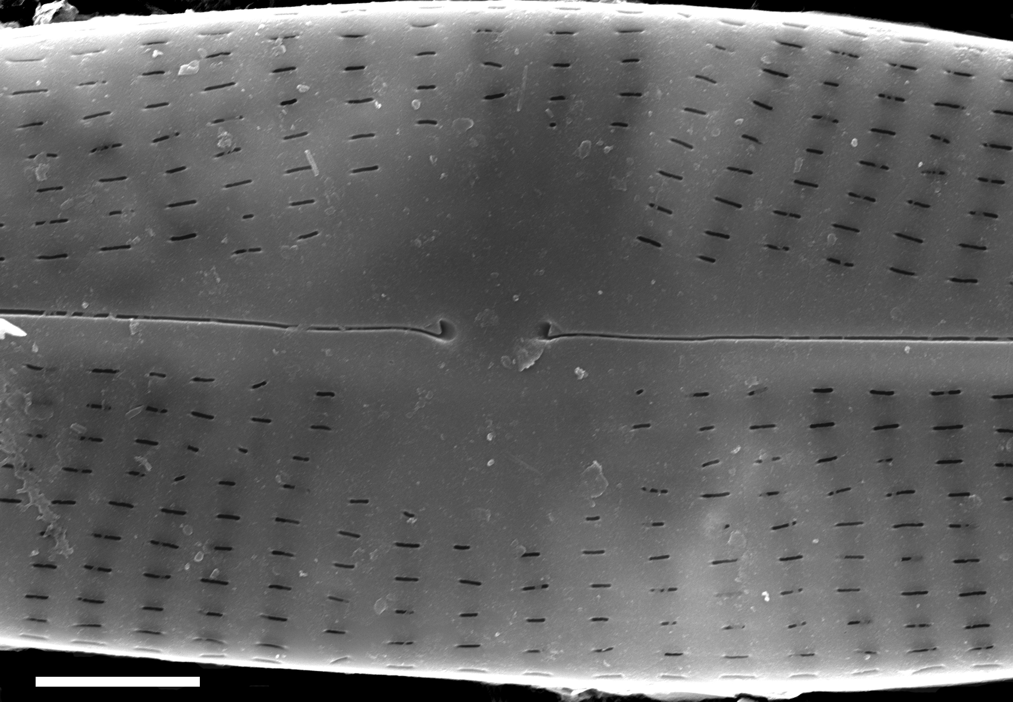 Navicula subrhynchocephala SEM2