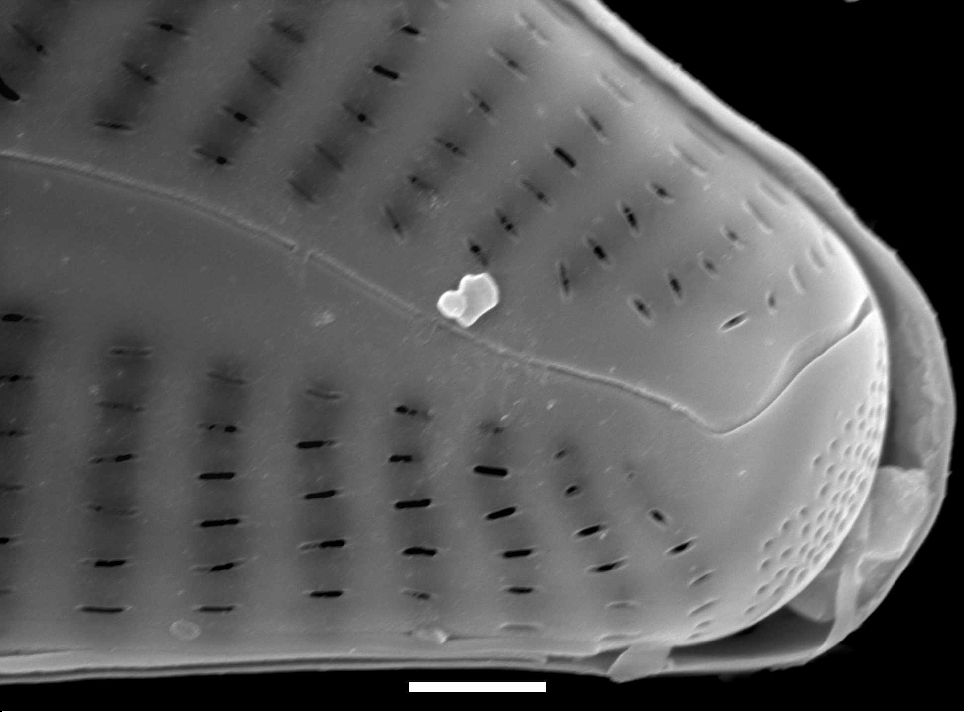 Cymbella tropica SEM3