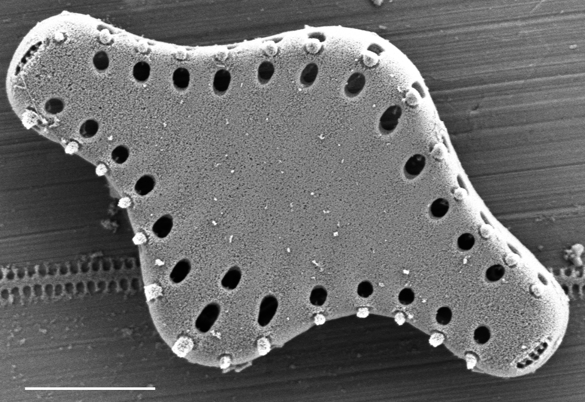 Pseudostaurosira pseudoconstruens SEM1