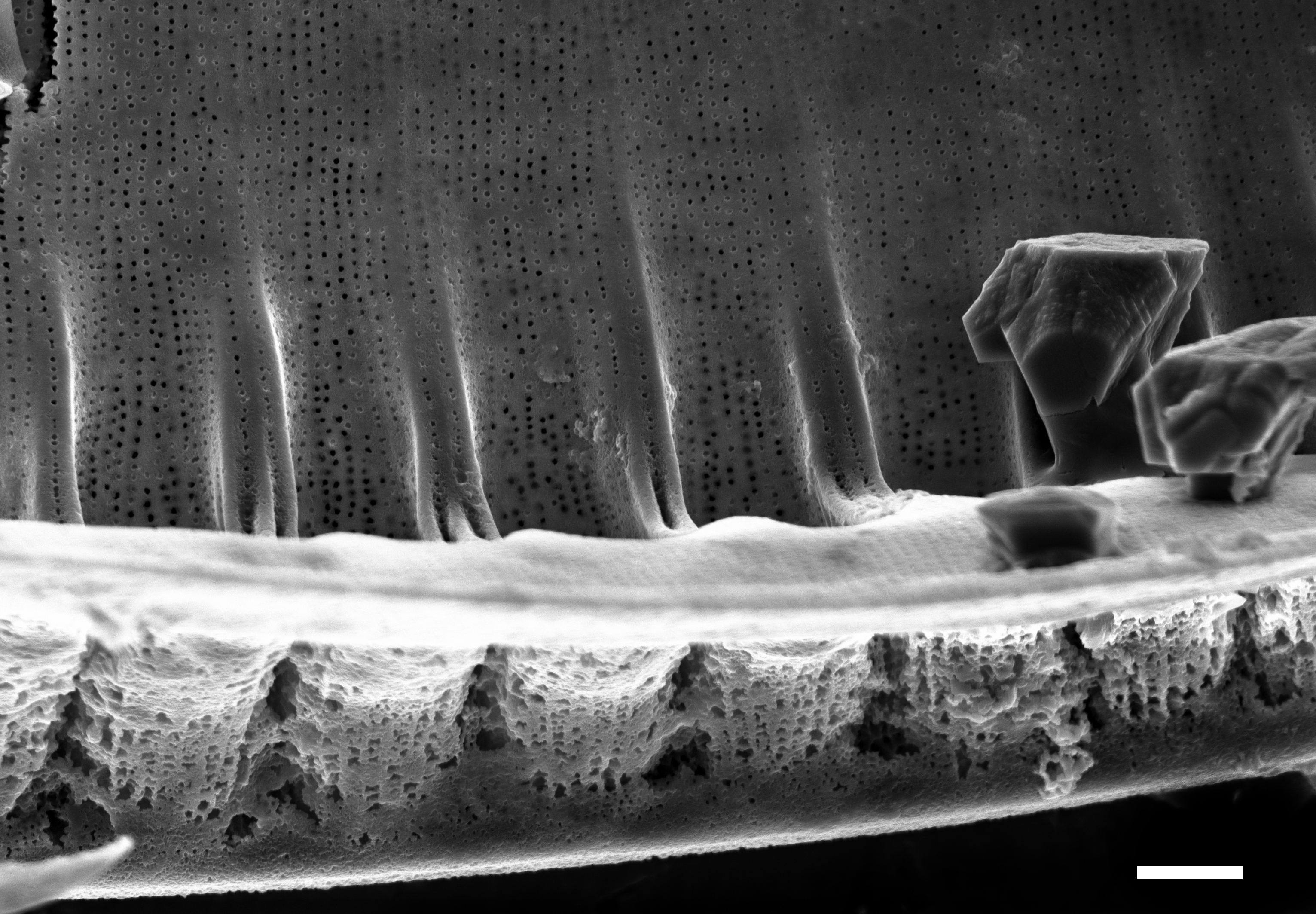 Iconella guatimalensis SEM3