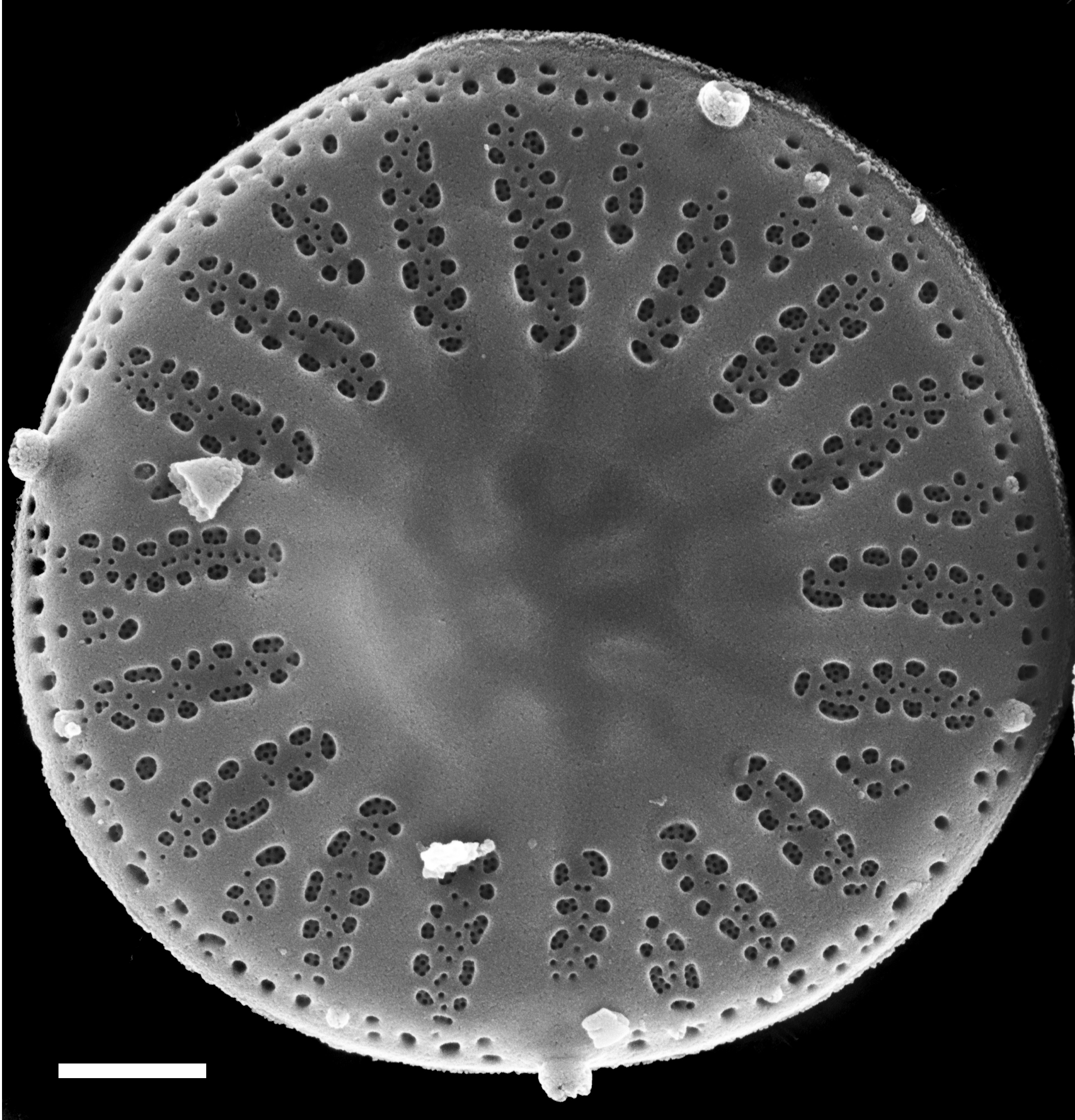 Discostella lakuskarluki SEM1