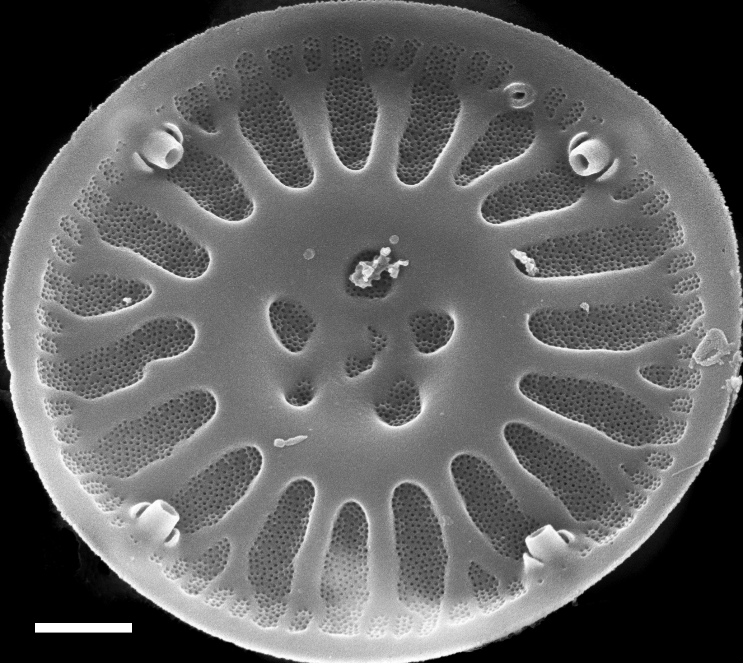 Discostella lakuskarluki SEM3