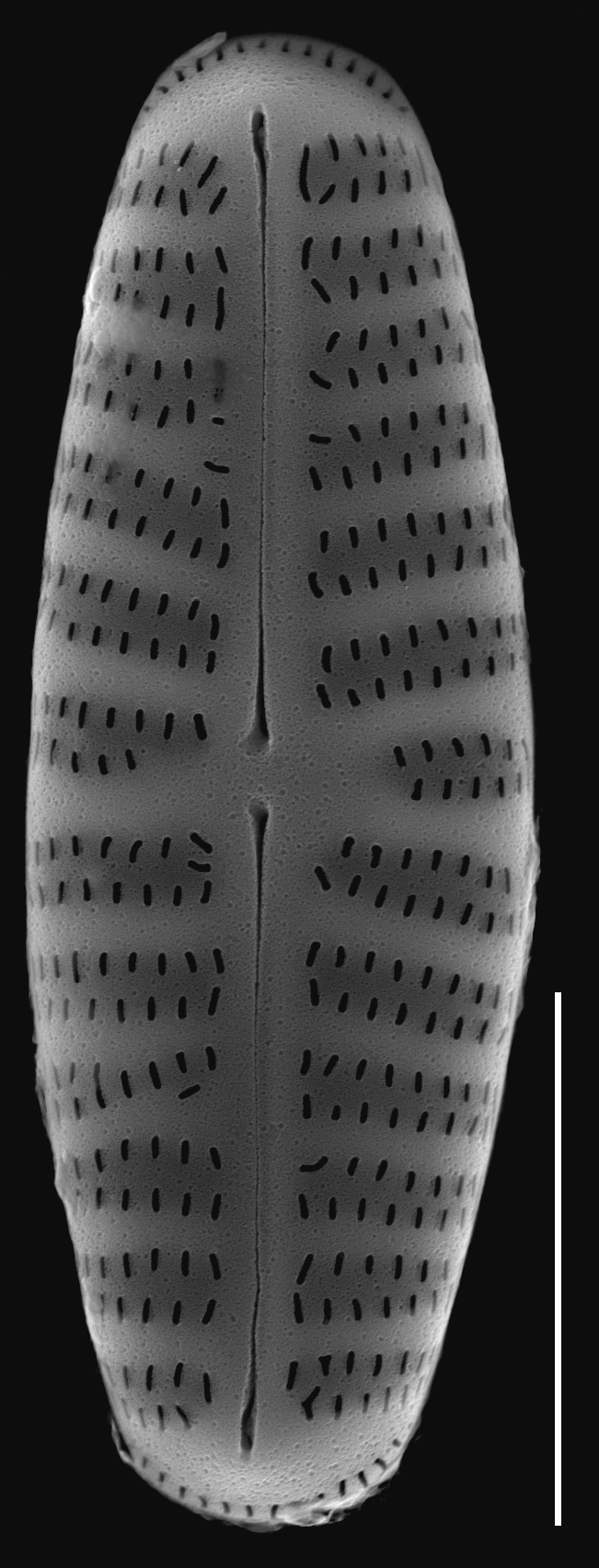 Hippodonta hungarica SEM1