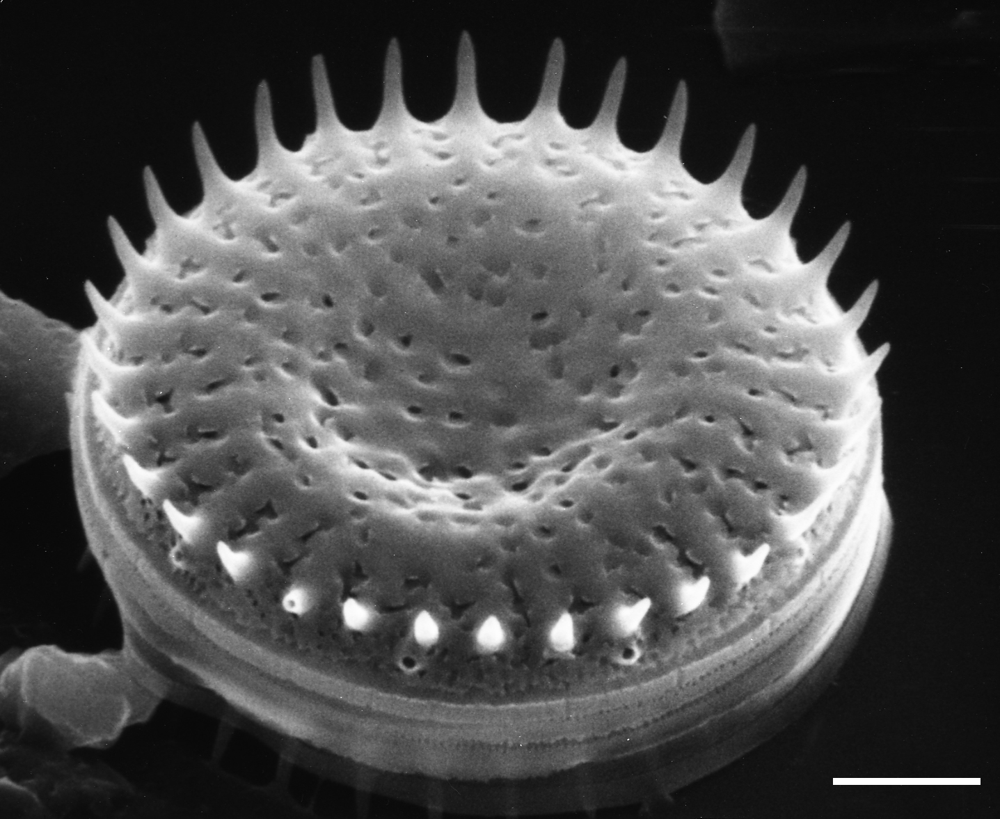 Stephanodiscus minutulus SEM1