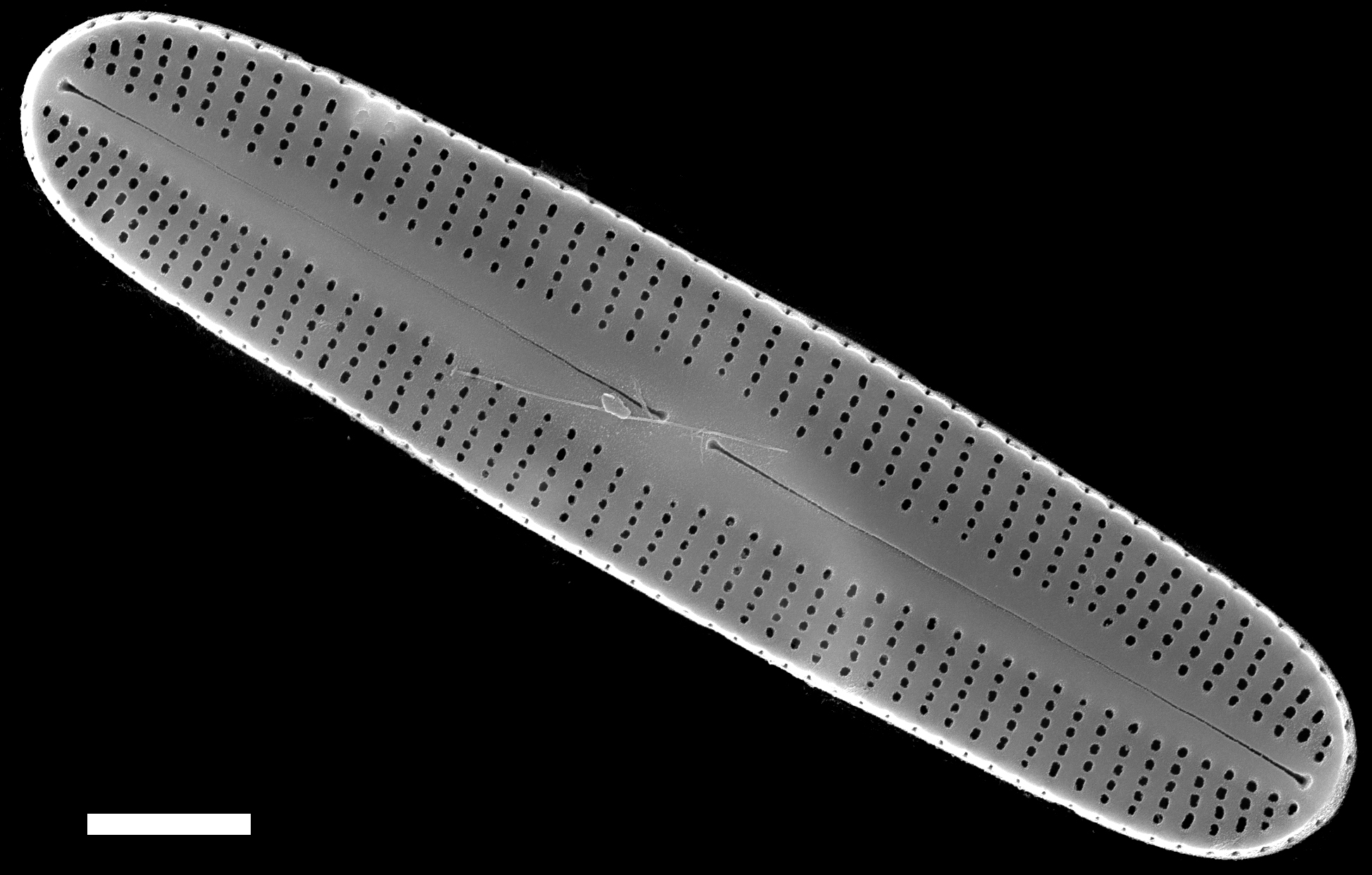 Rossithidium anastasiae SEM2