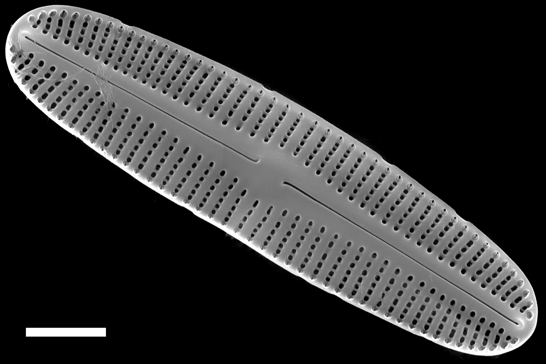 Rossithidium anastasiae SEM3