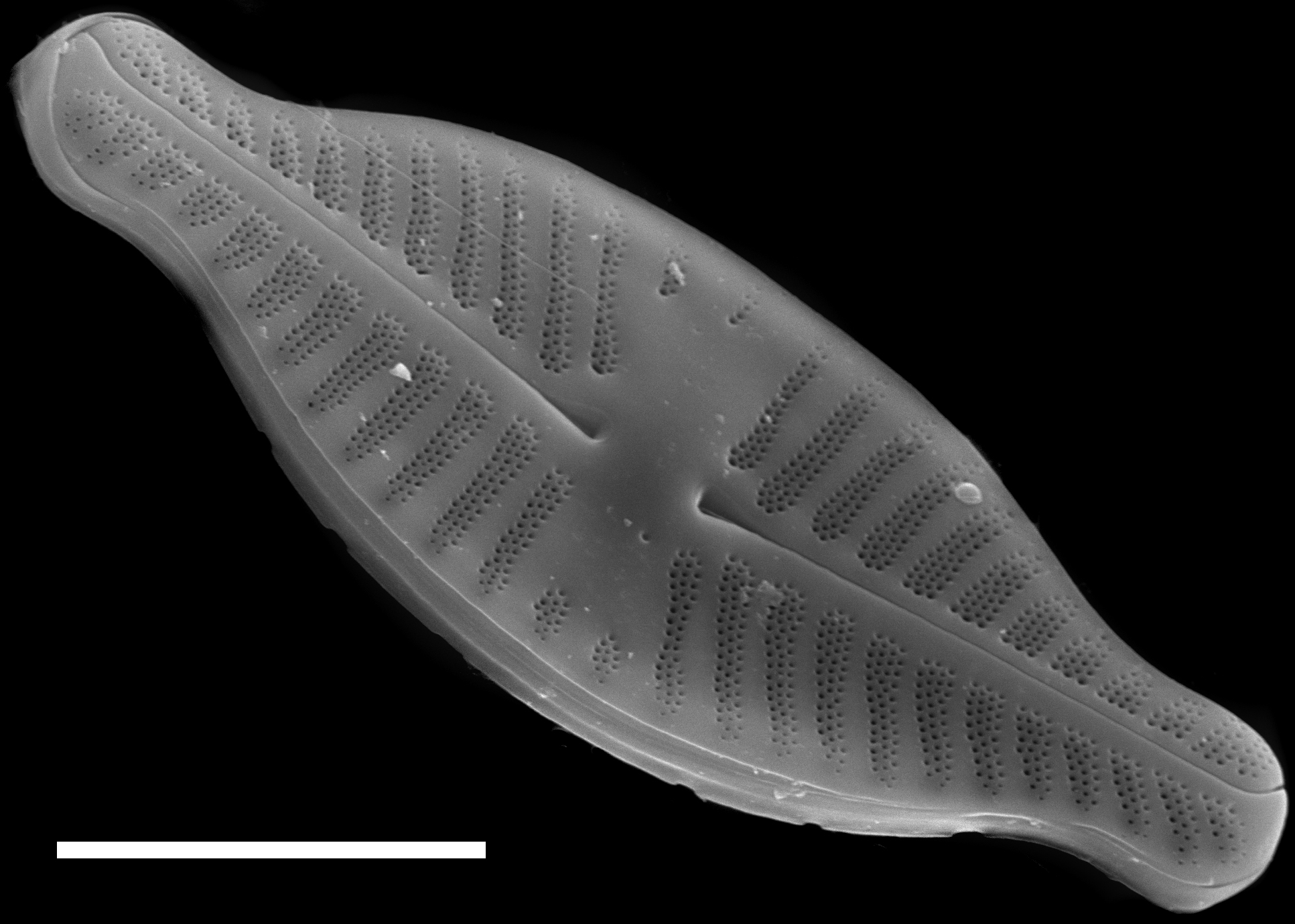 Planothidium dubium SEM1