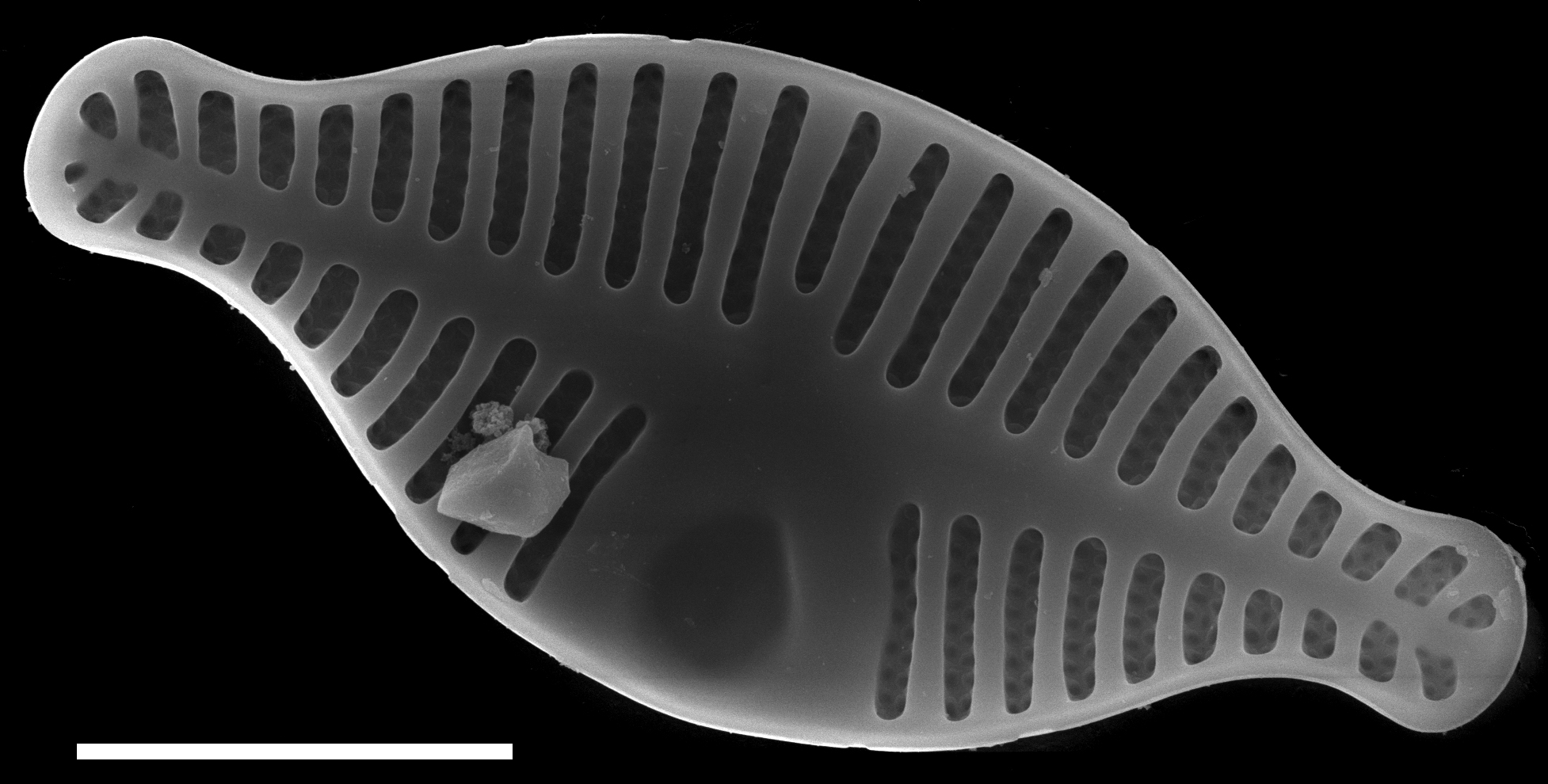 Planothidium dubium SEM2