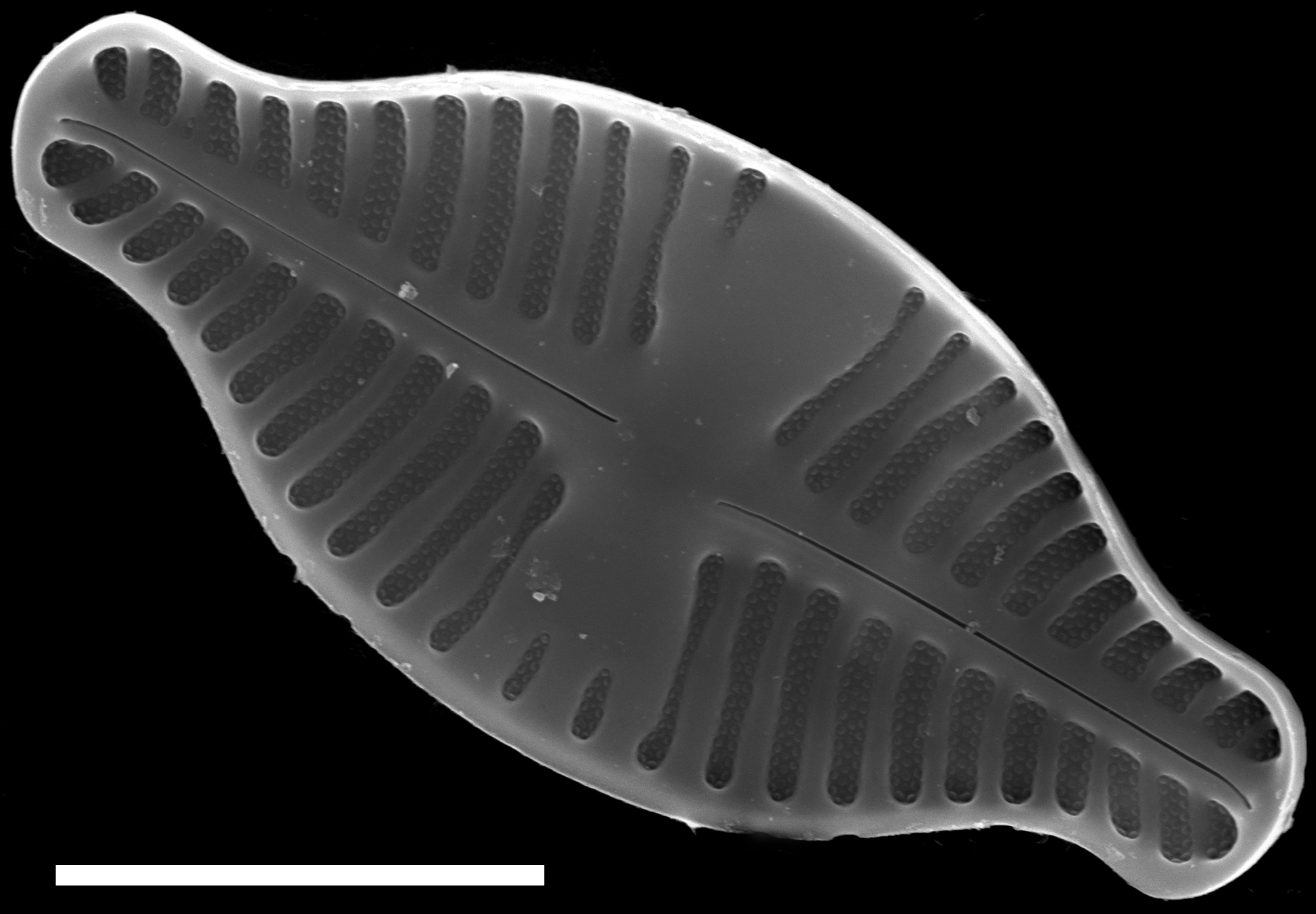 Planothidium dubium SEM3