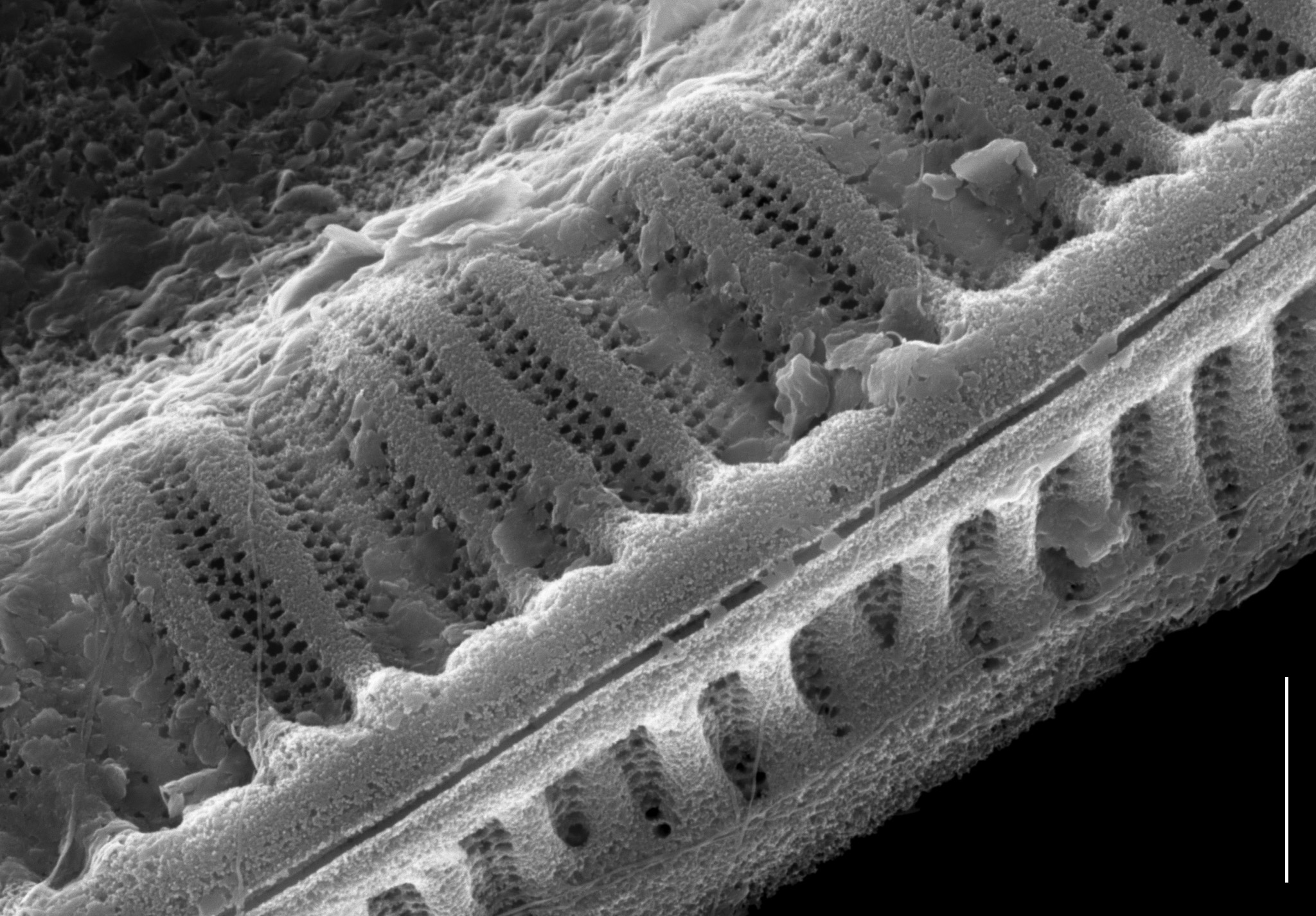 Surirella iowensis SEM4