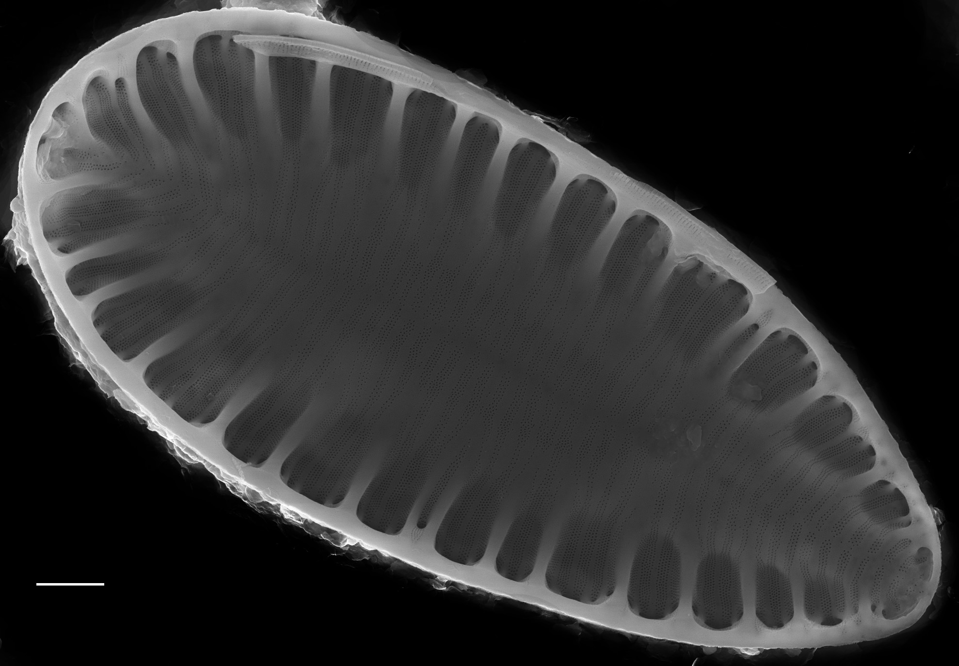 Surirella brebissonii SEM1