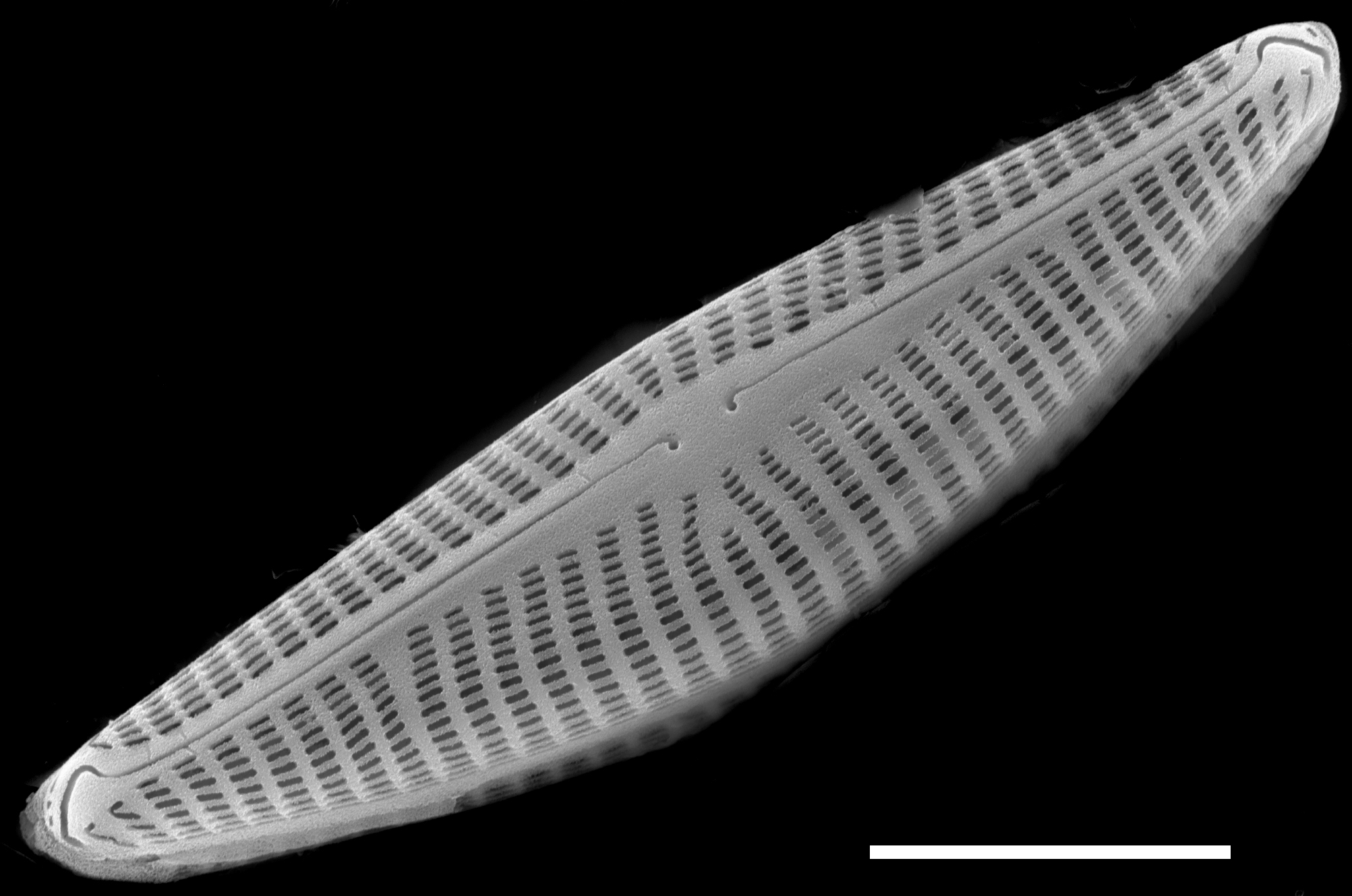 Navicymbula pusilla SEM1