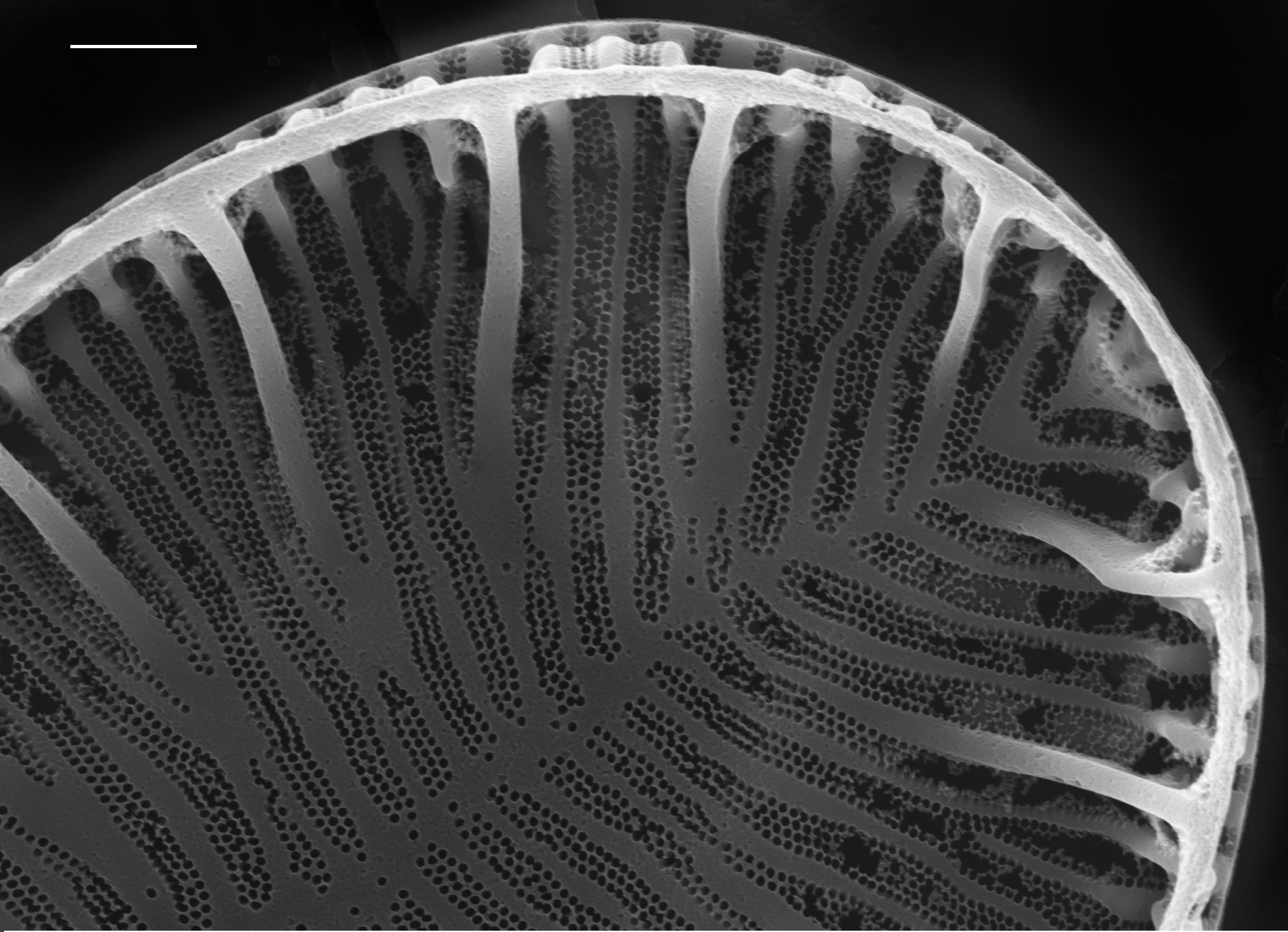 Surirella brebissonii SEM4