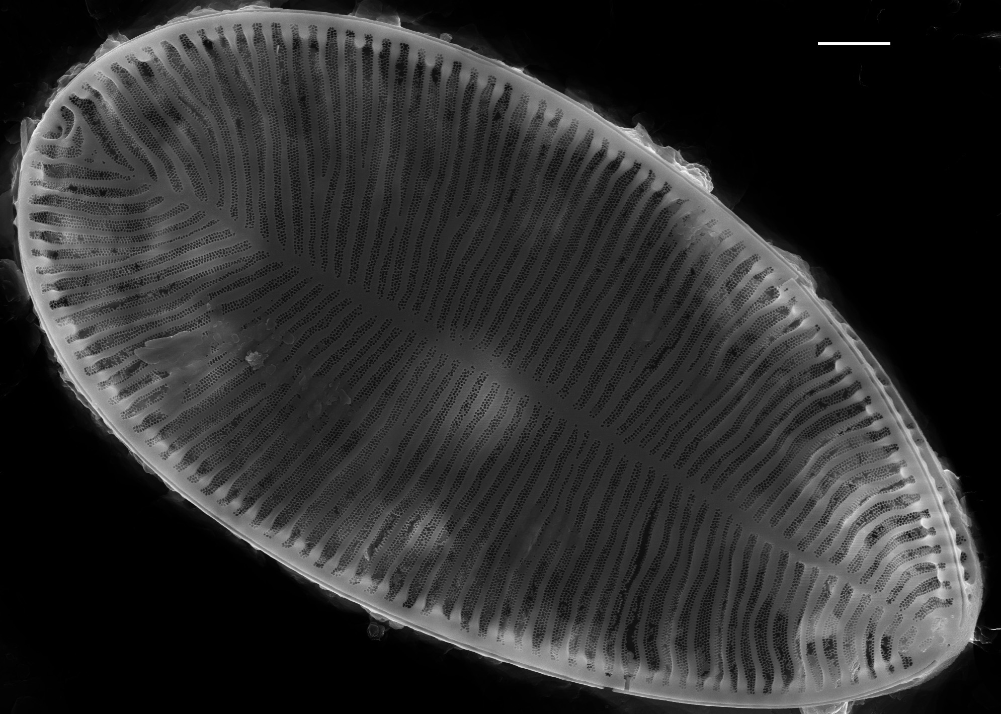 Surirella brebissonii SEM3