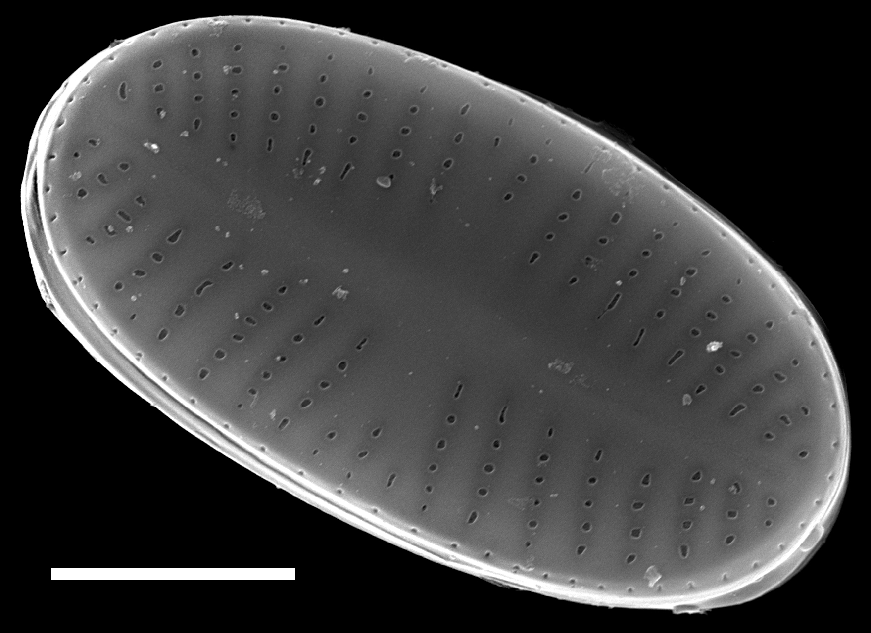 Psammothidium curtissimum SEM4