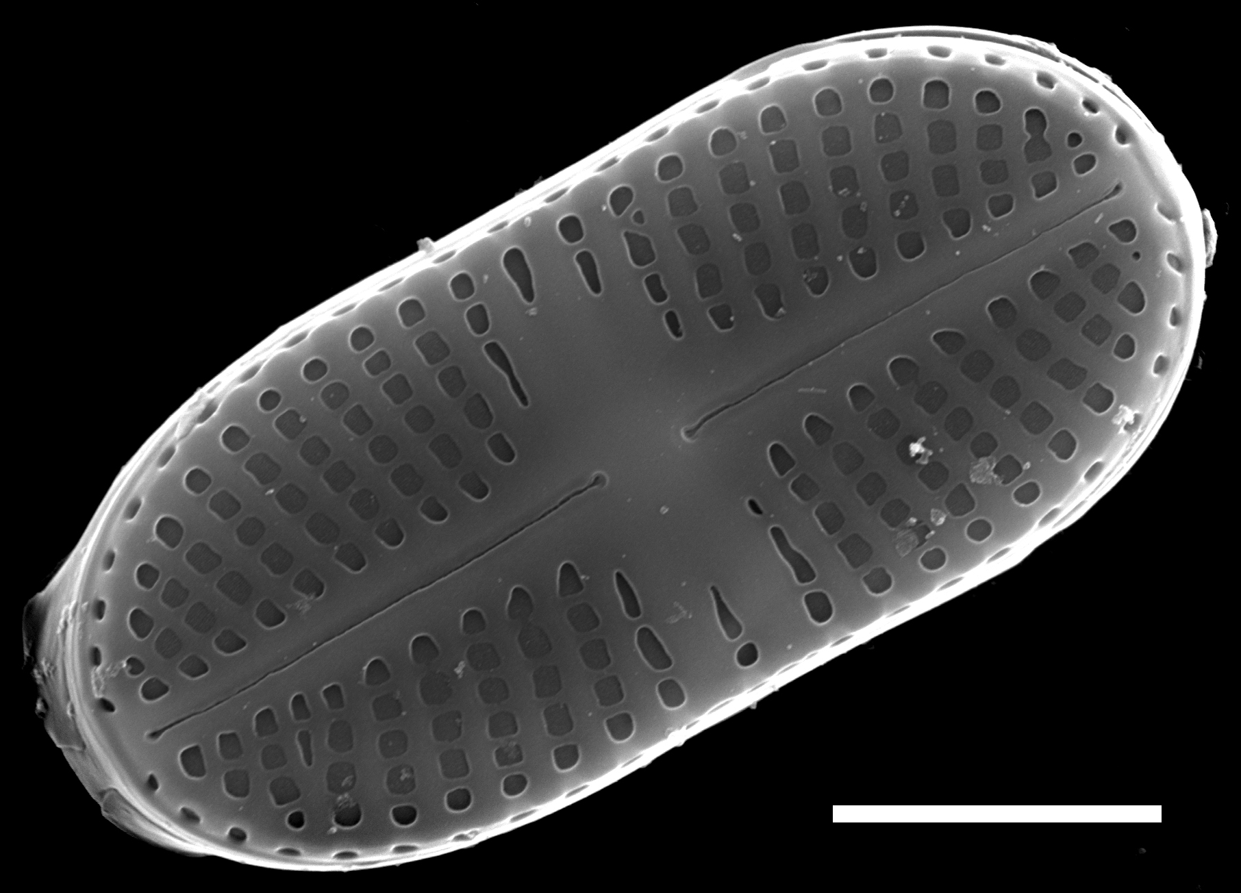 Psammothidium didymum SEM4