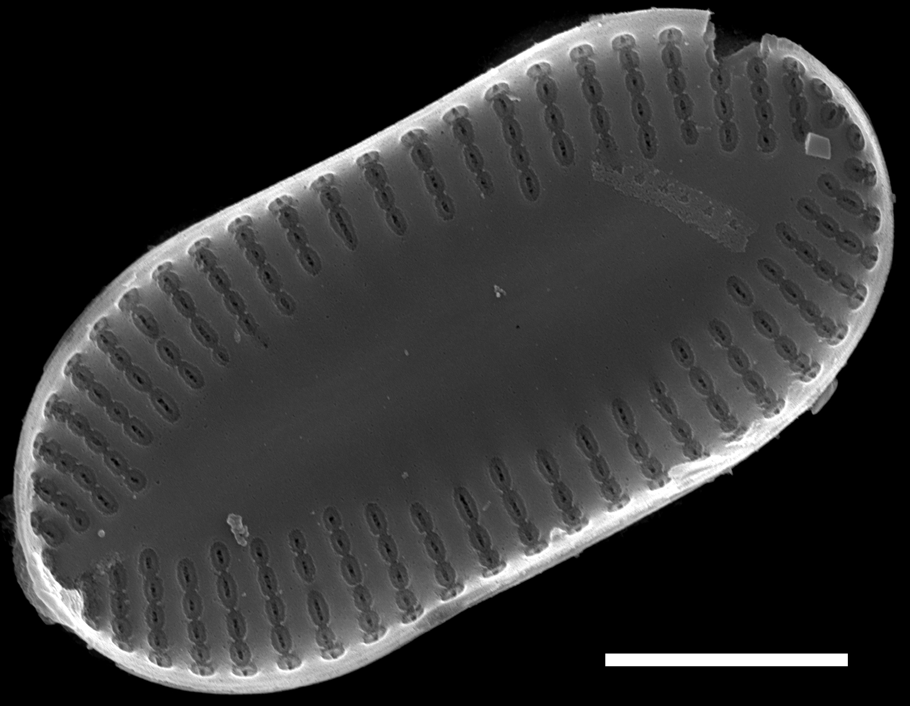 Psammothidium didymum SEM7