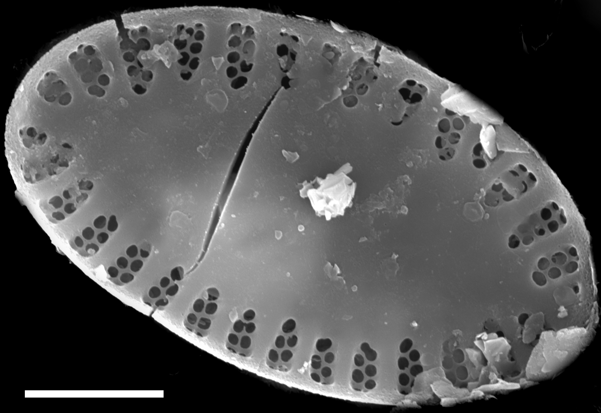 Platessa lutheri SEM1