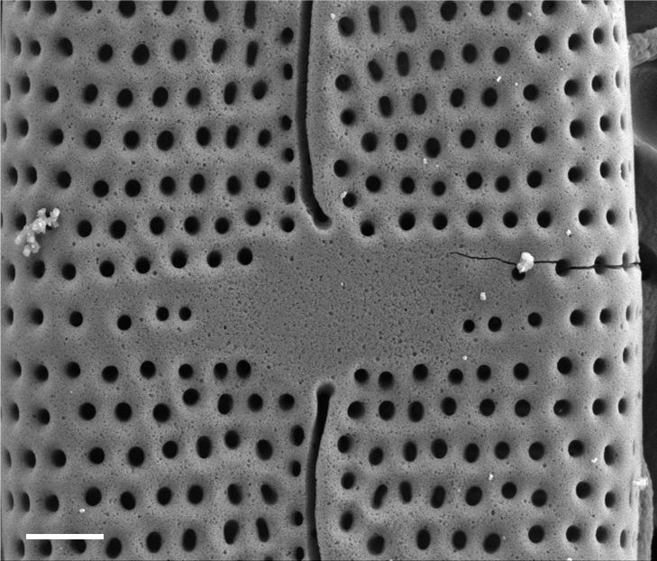 Mastogloia calcarea SEM1