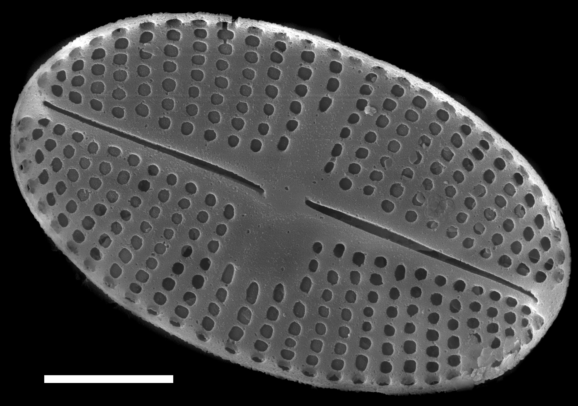 Psammothidium levanderi SEM1