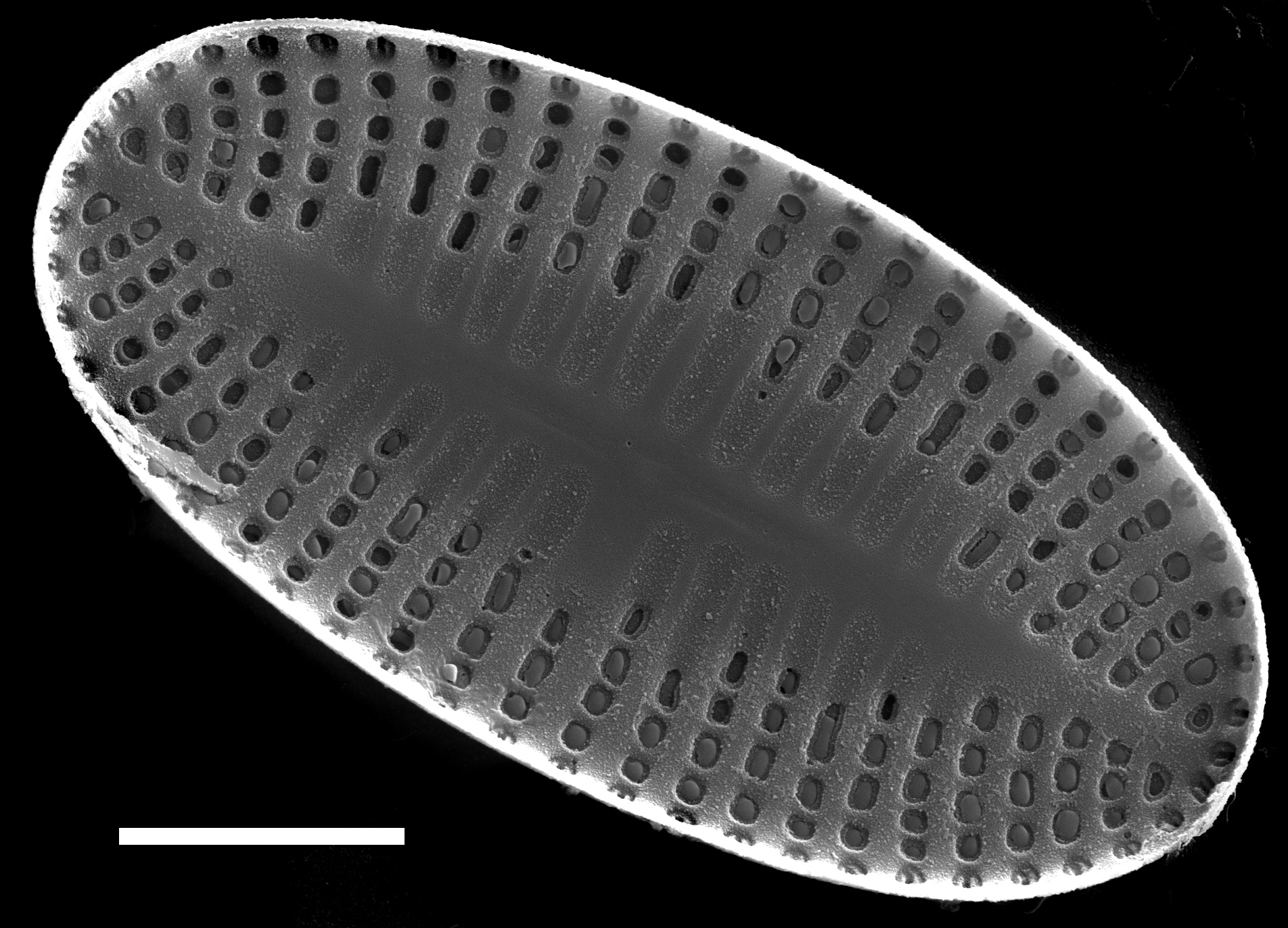 Psammothidium levanderi SEM2