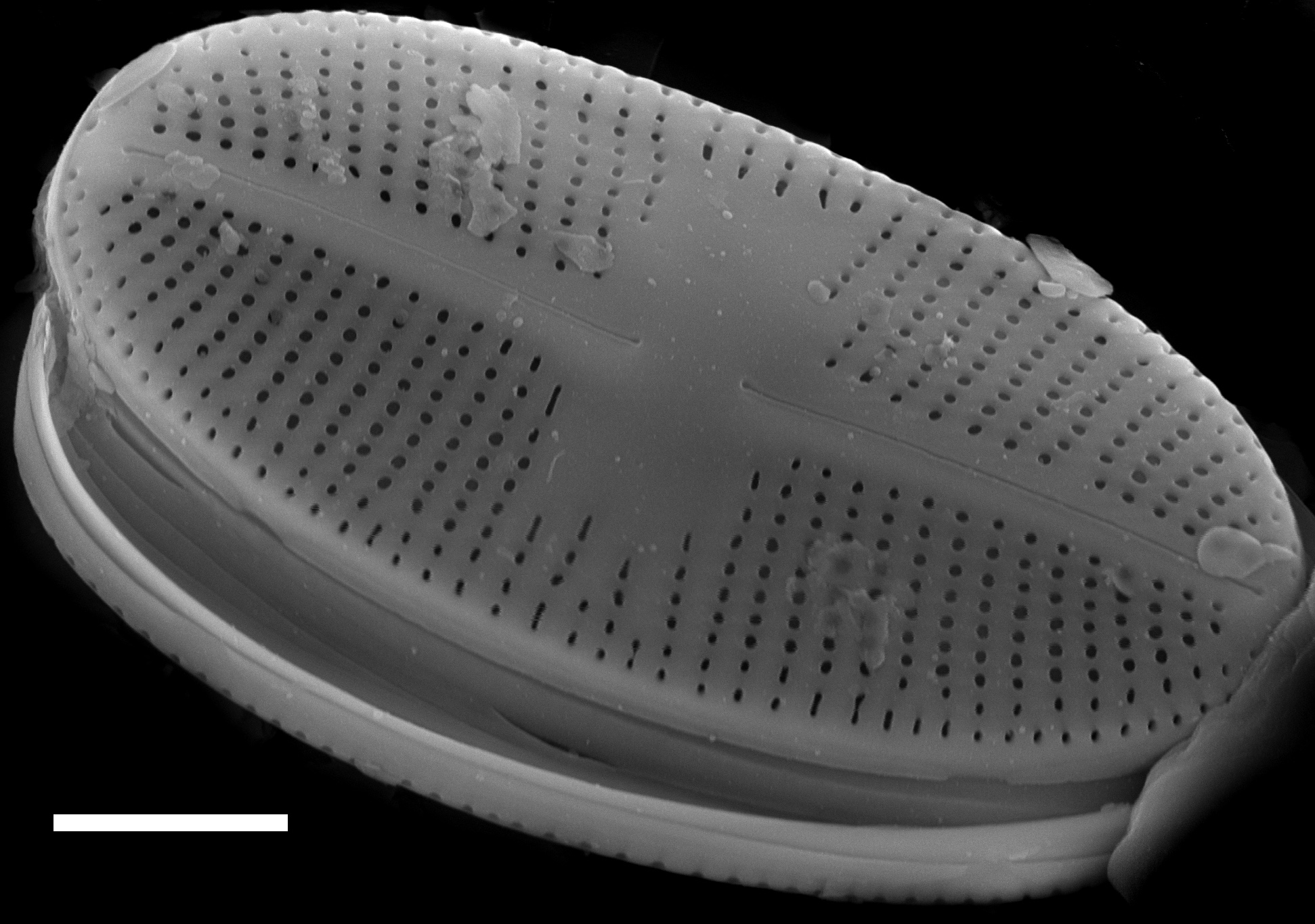 Psammothidium daonense SEM2