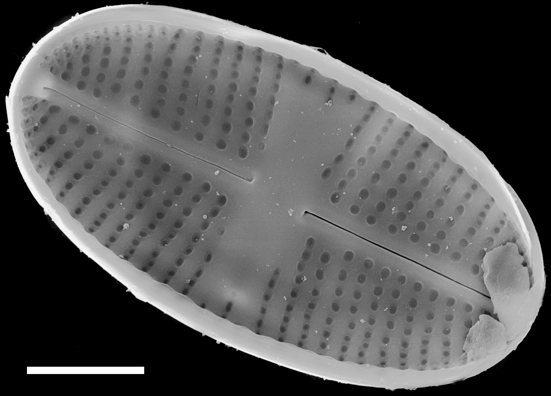 Psammothidium pennsylvanicum SEM4