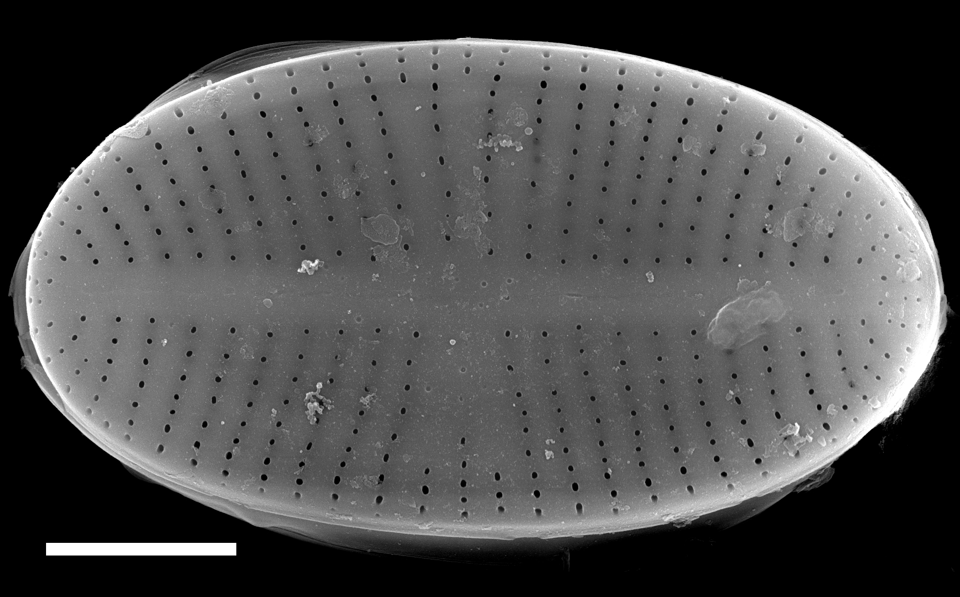 Psammothidium pennsylvanicum SEM2