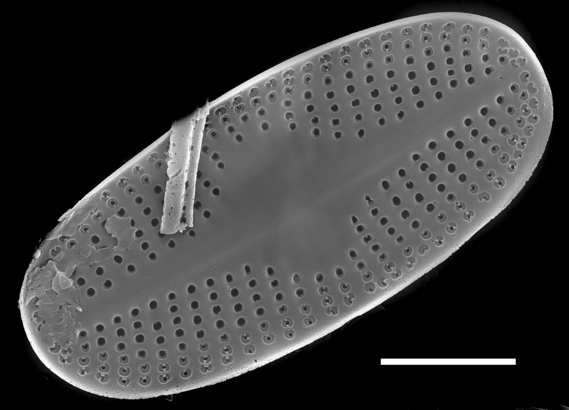 Psammothidium scoticum SEM1