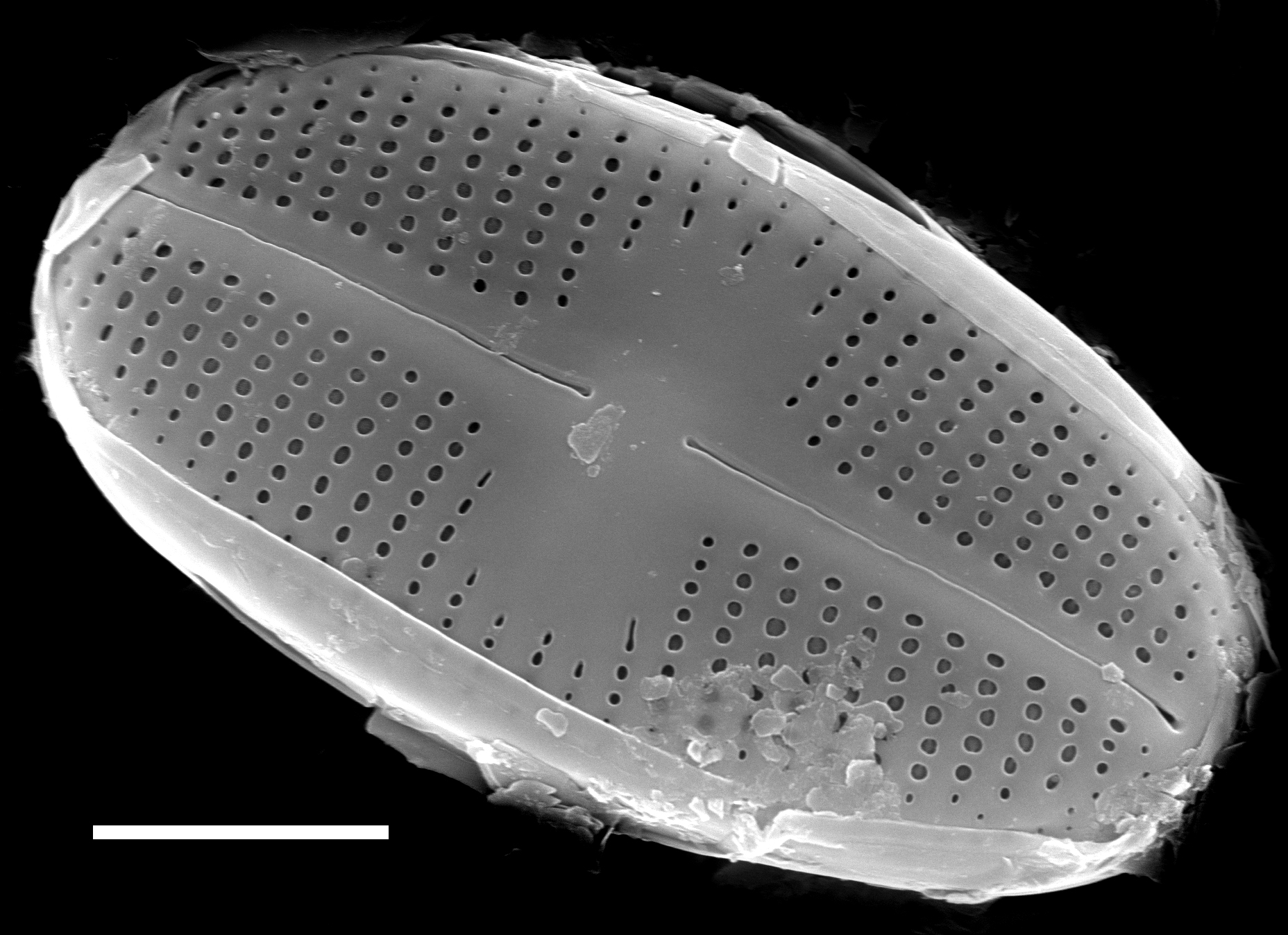 Psammothidium scoticum SEM2