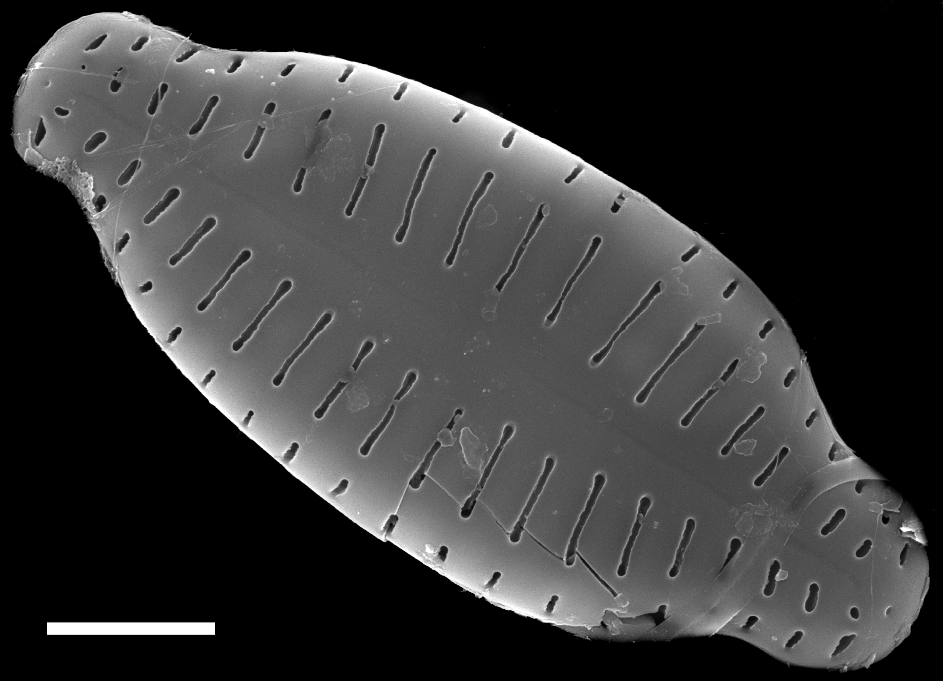 Karayevia ploenensis var gessneri SEM1