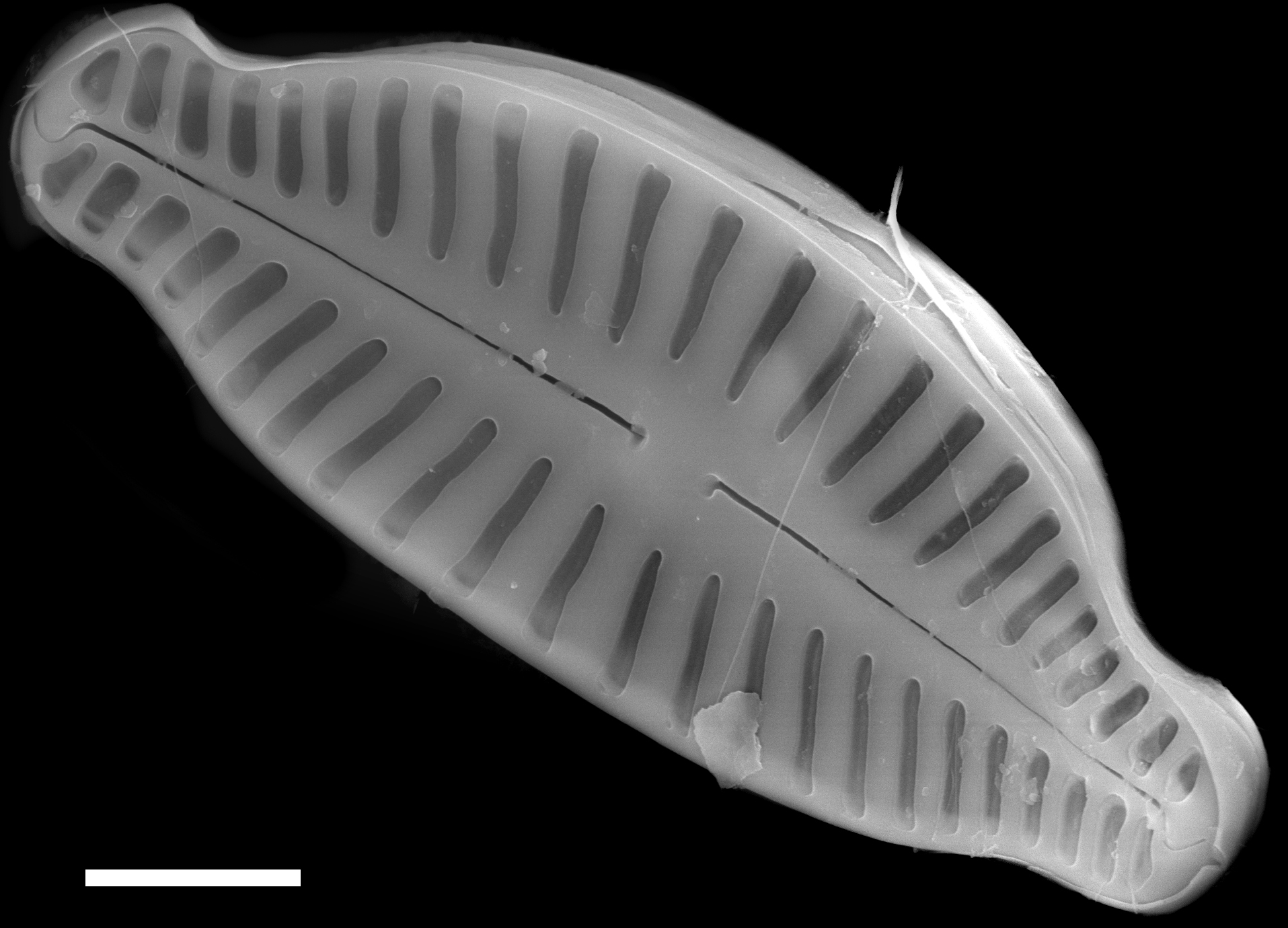 Karayevia ploenensis var gessneri SEM2