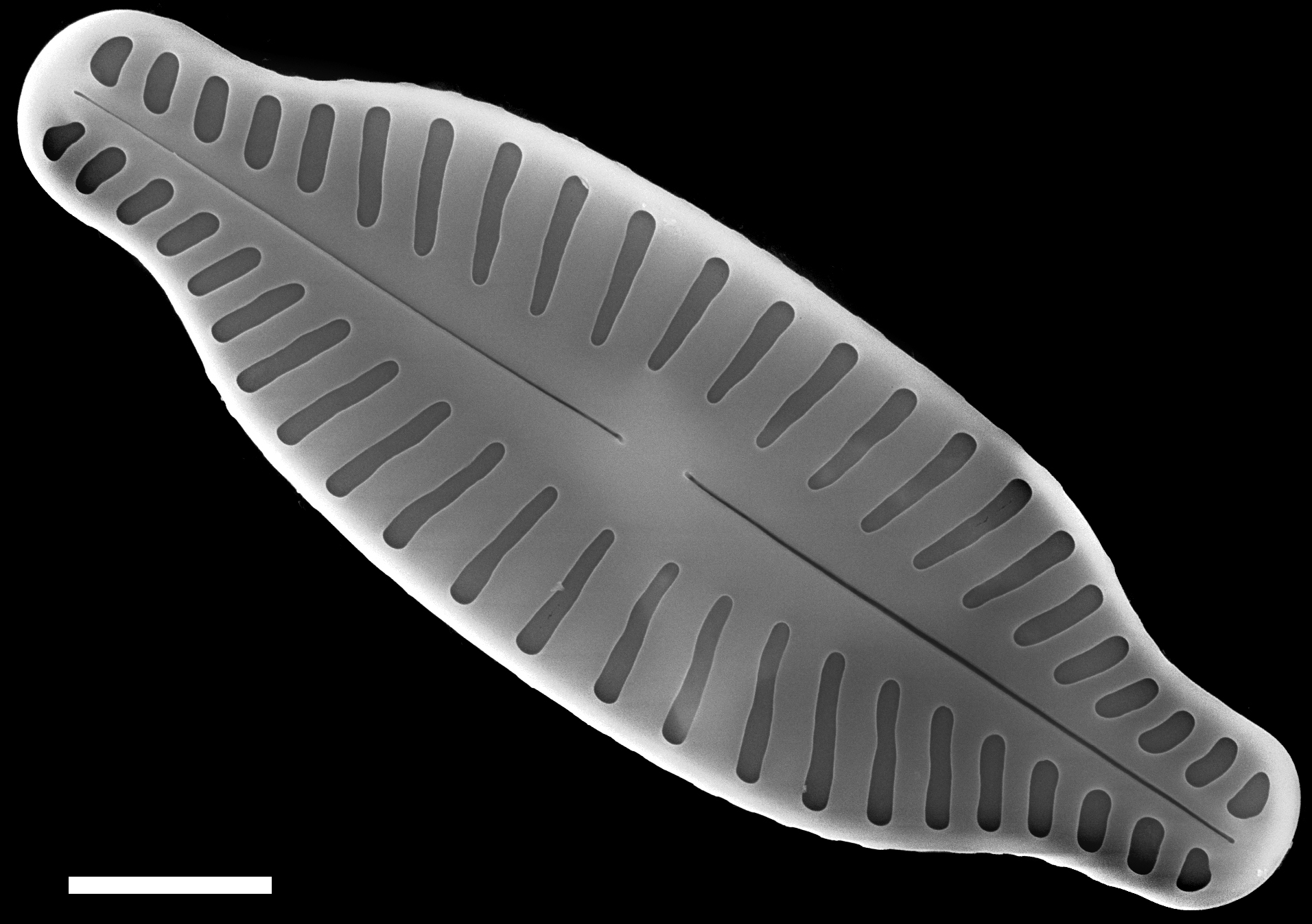 Karayevia ploenensis var gessneri SEM3