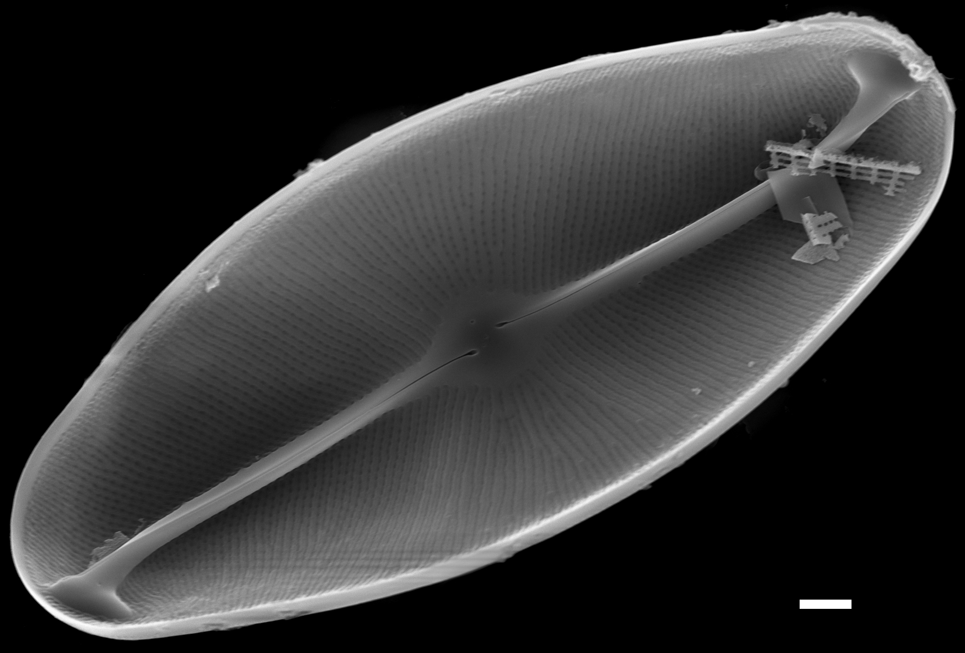 Eucocconeis flexella SEM1