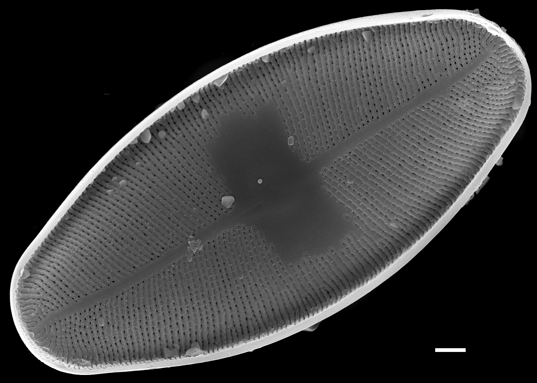 Eucocconeis flexella SEM2