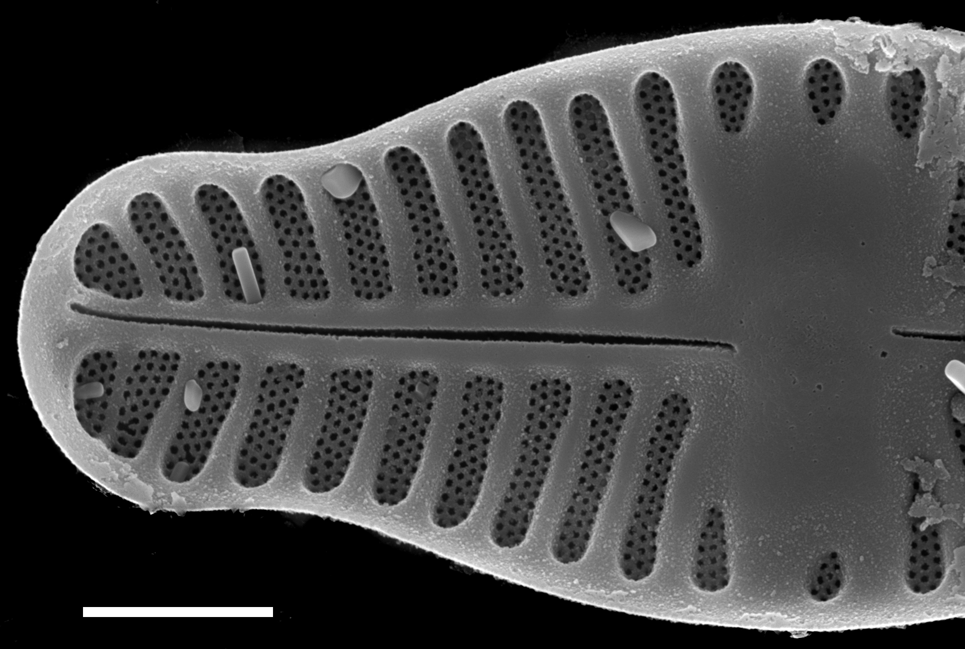 Planothidium haynaldii SEM2